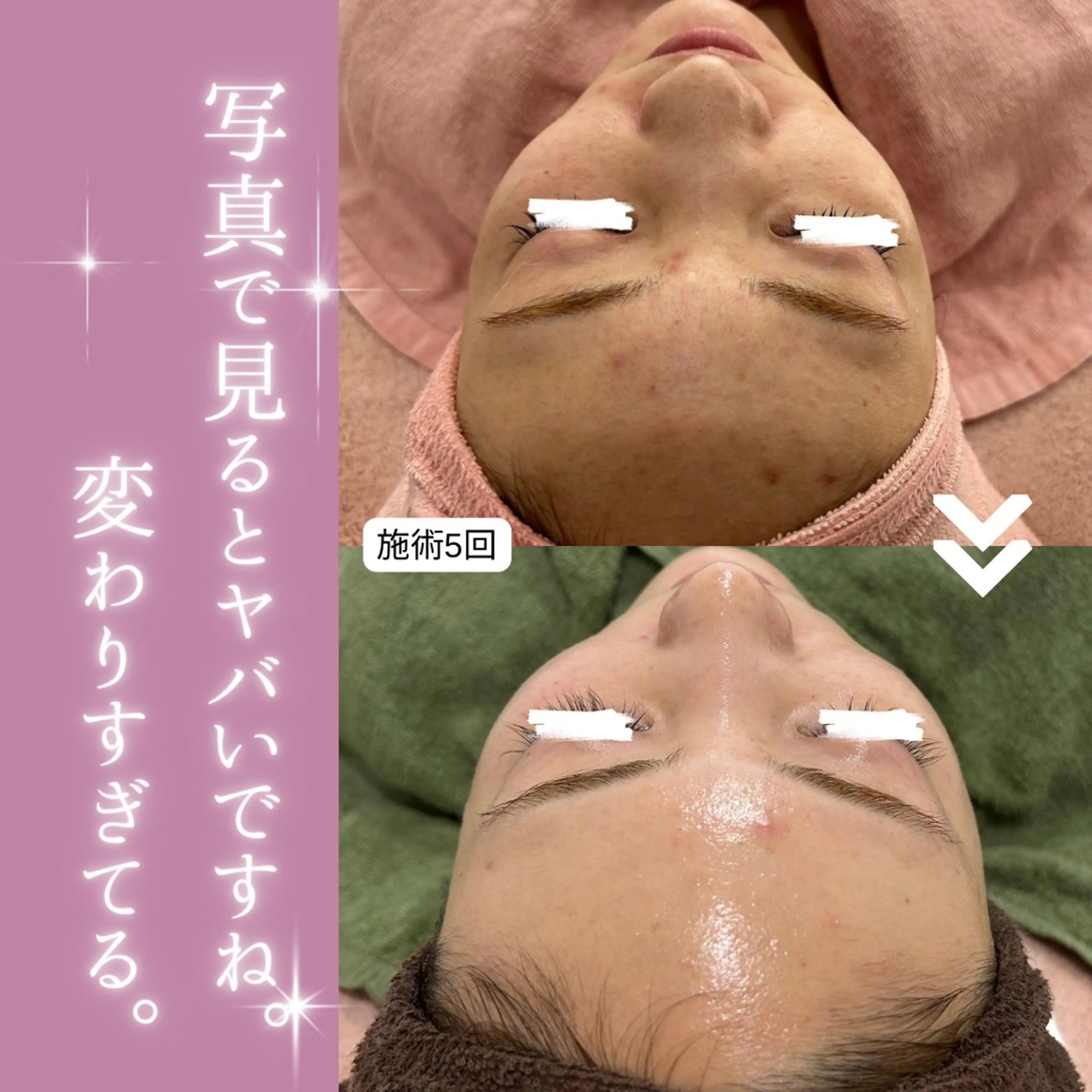 【現役看護師】高来 笑子のエステ・リラクイメージ