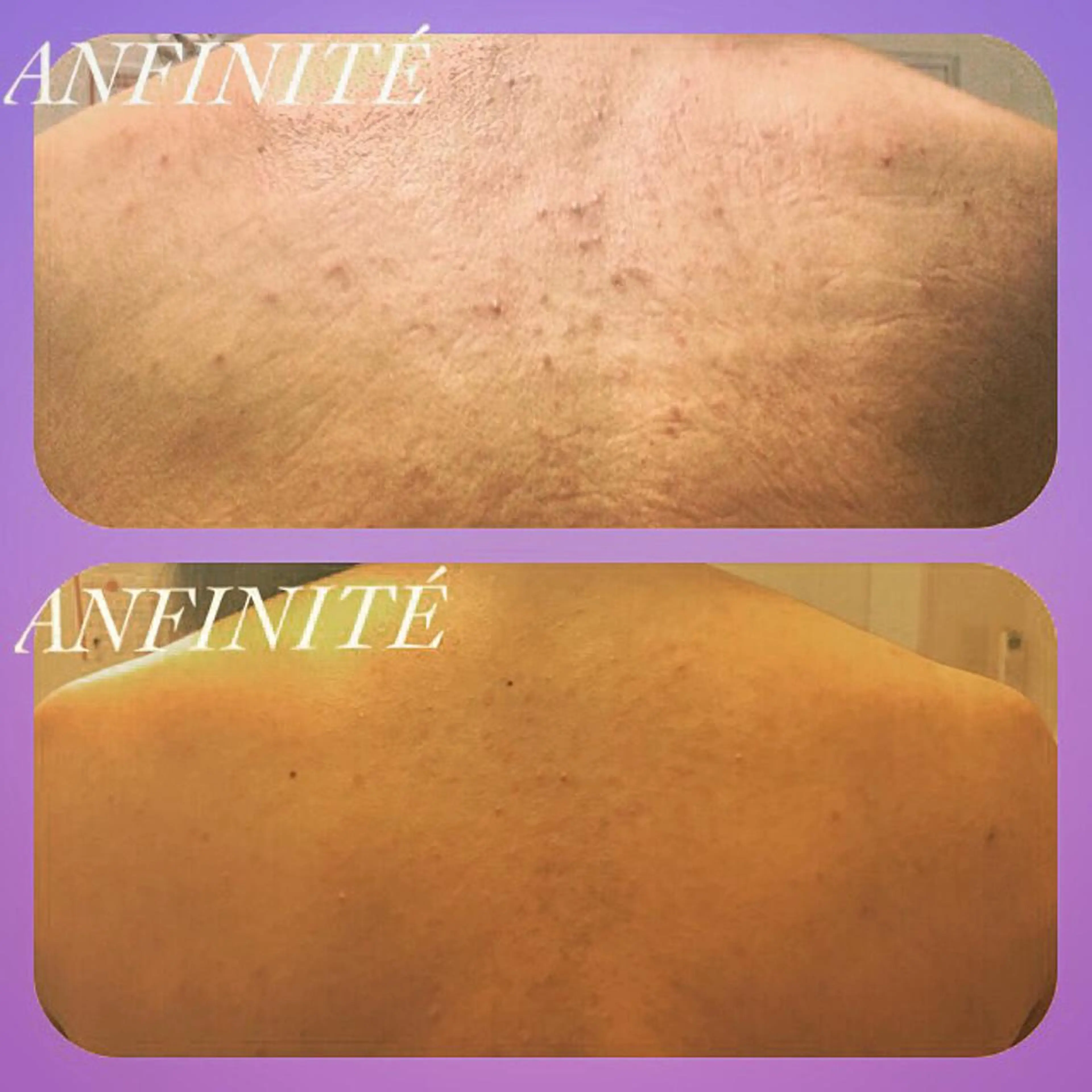 ANFINITÉ アンフィニテのエステ・リラクイメージ