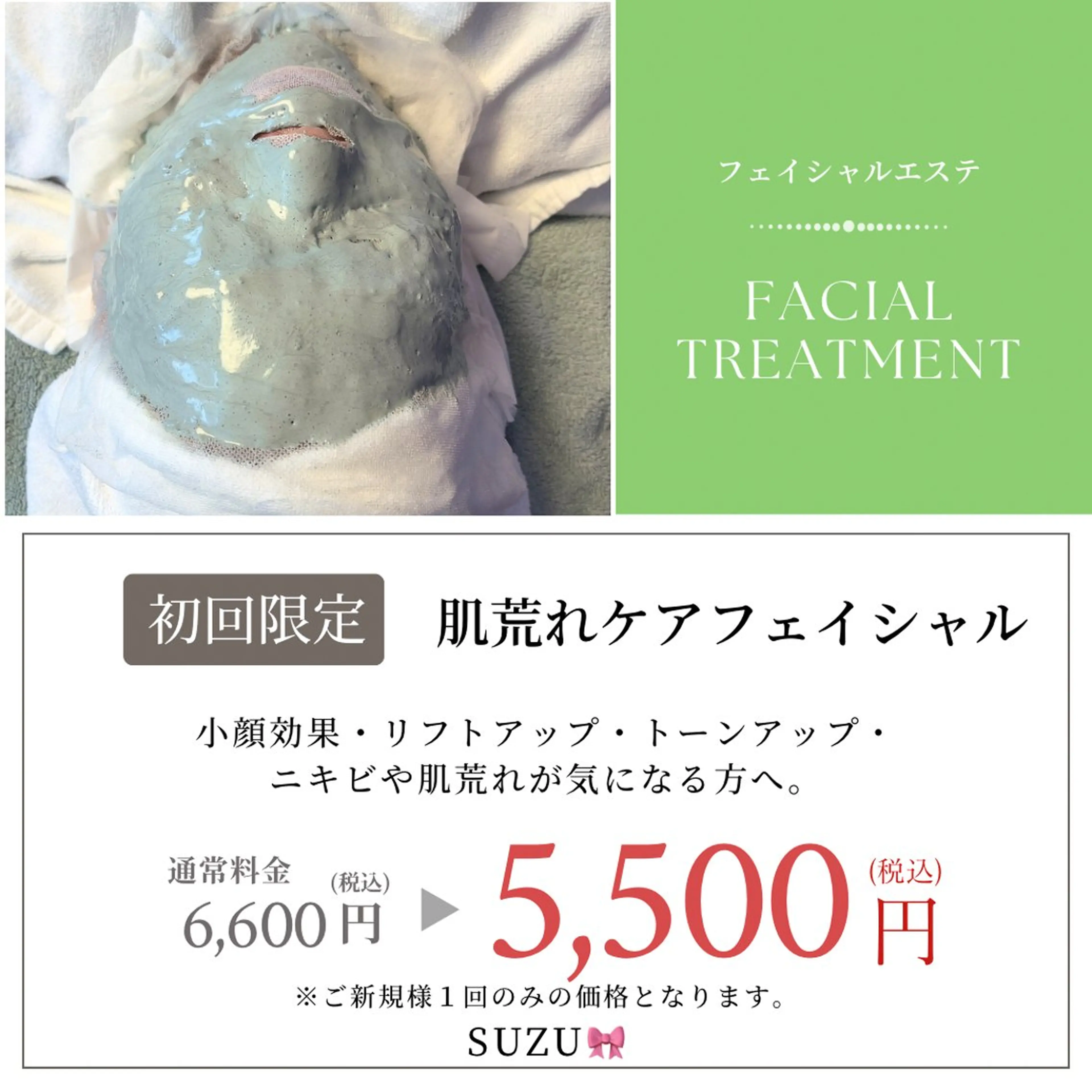 肌荒れケアフェイシャル（ニキビ）の写真