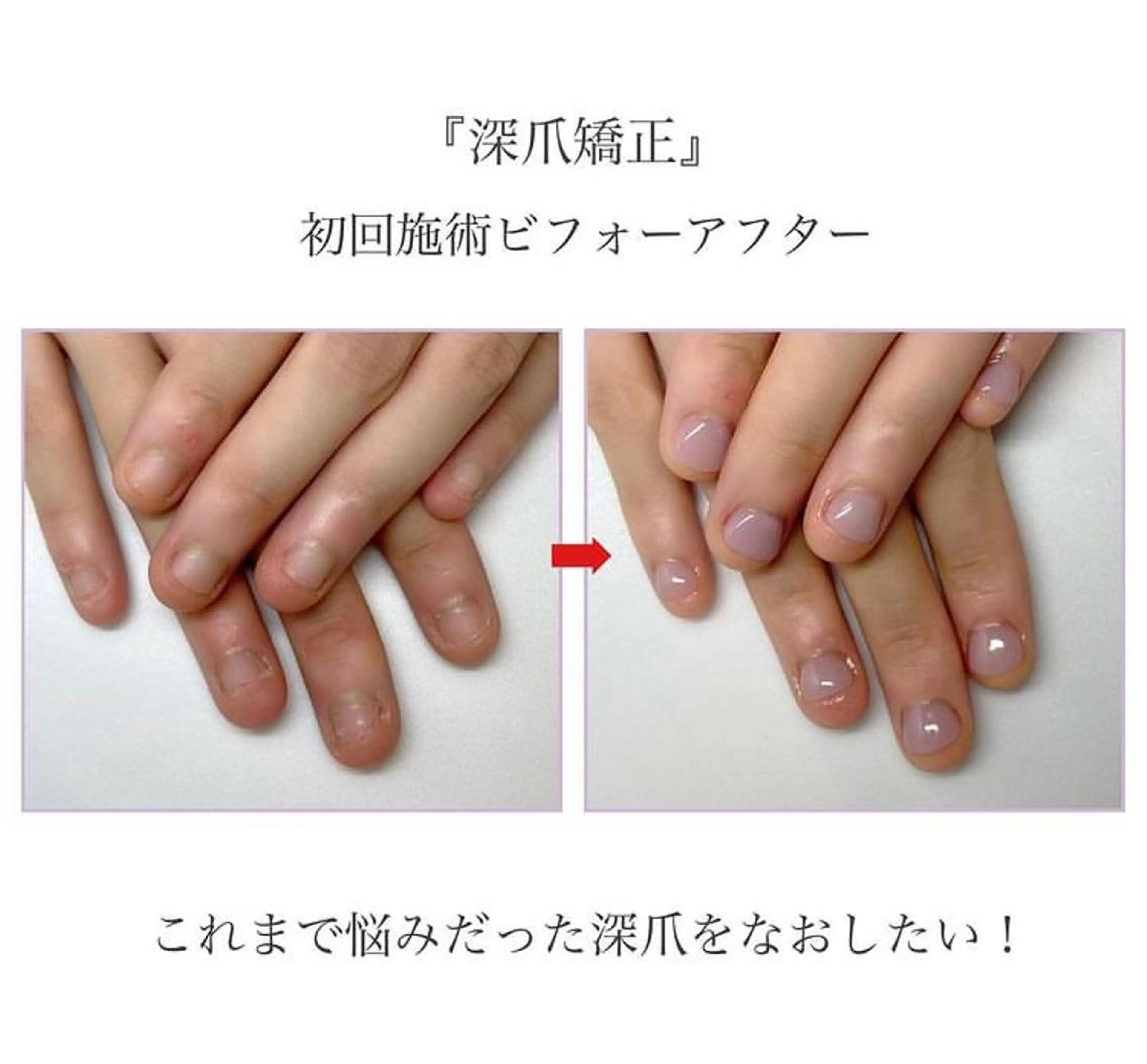 ネイル ネイルサロン アリュームのネイルデザイン