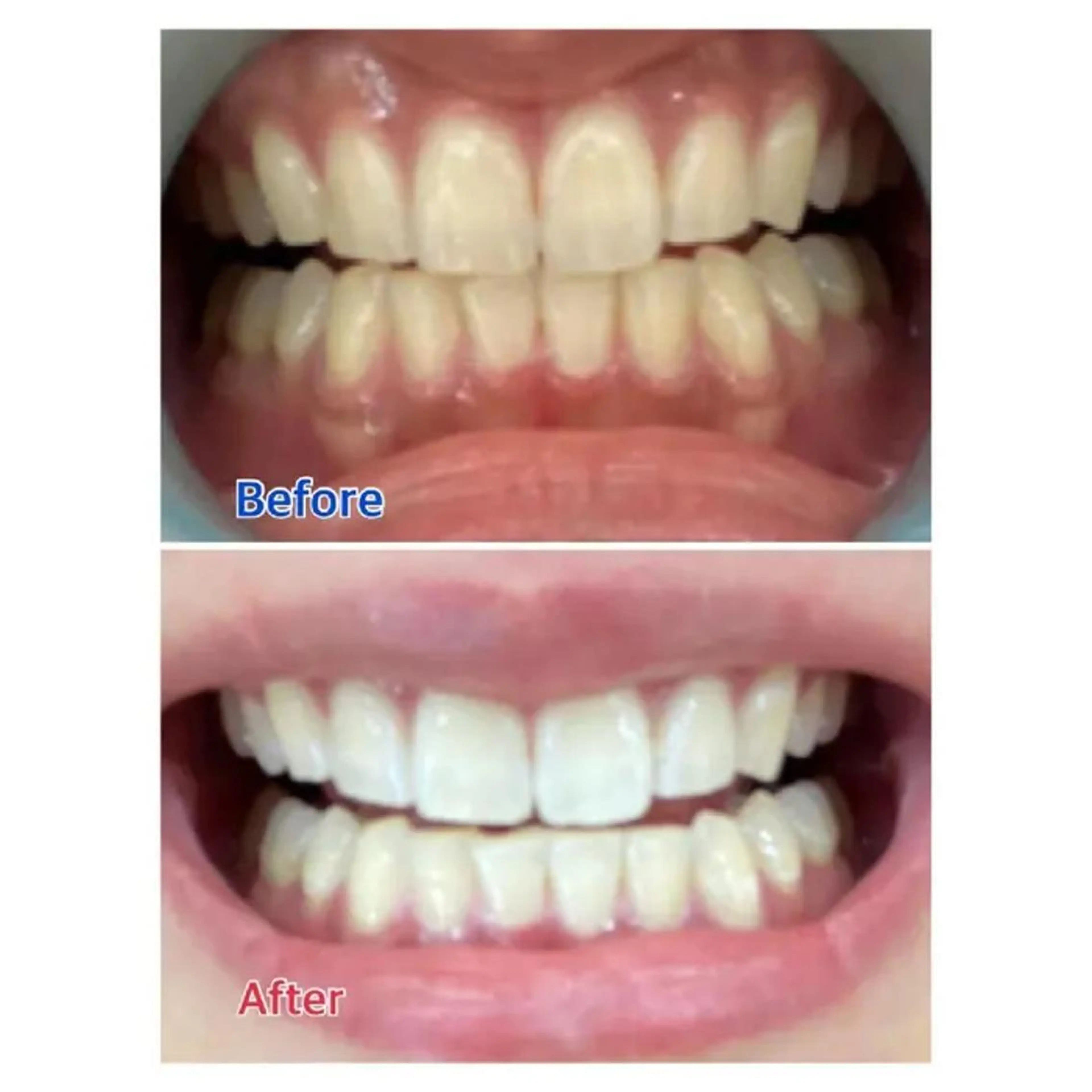 M渋谷 ホワイトニングのその他イメージ