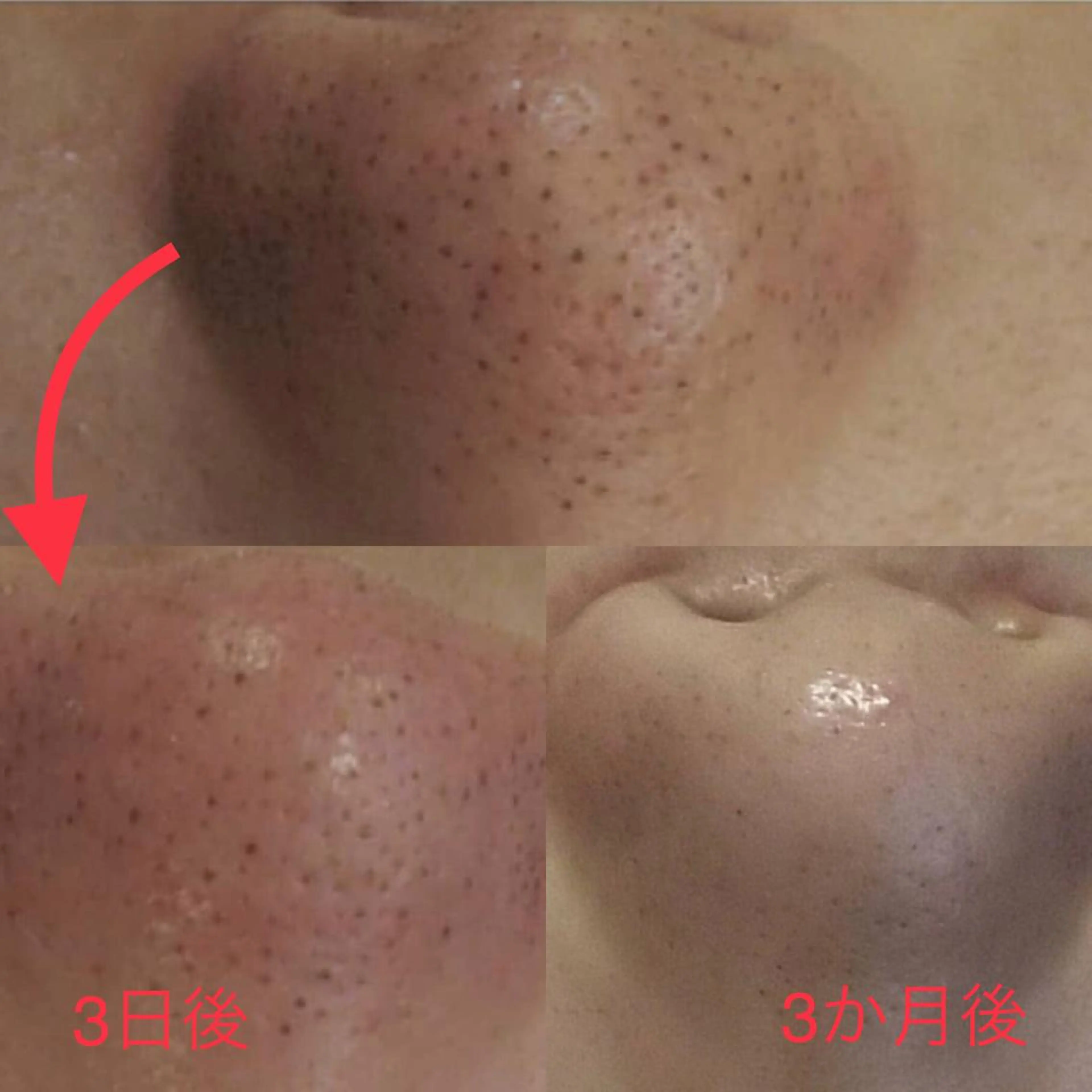 ROOM.S ｜脱毛｜美肌｜ボディのエステ・リラクイメージ