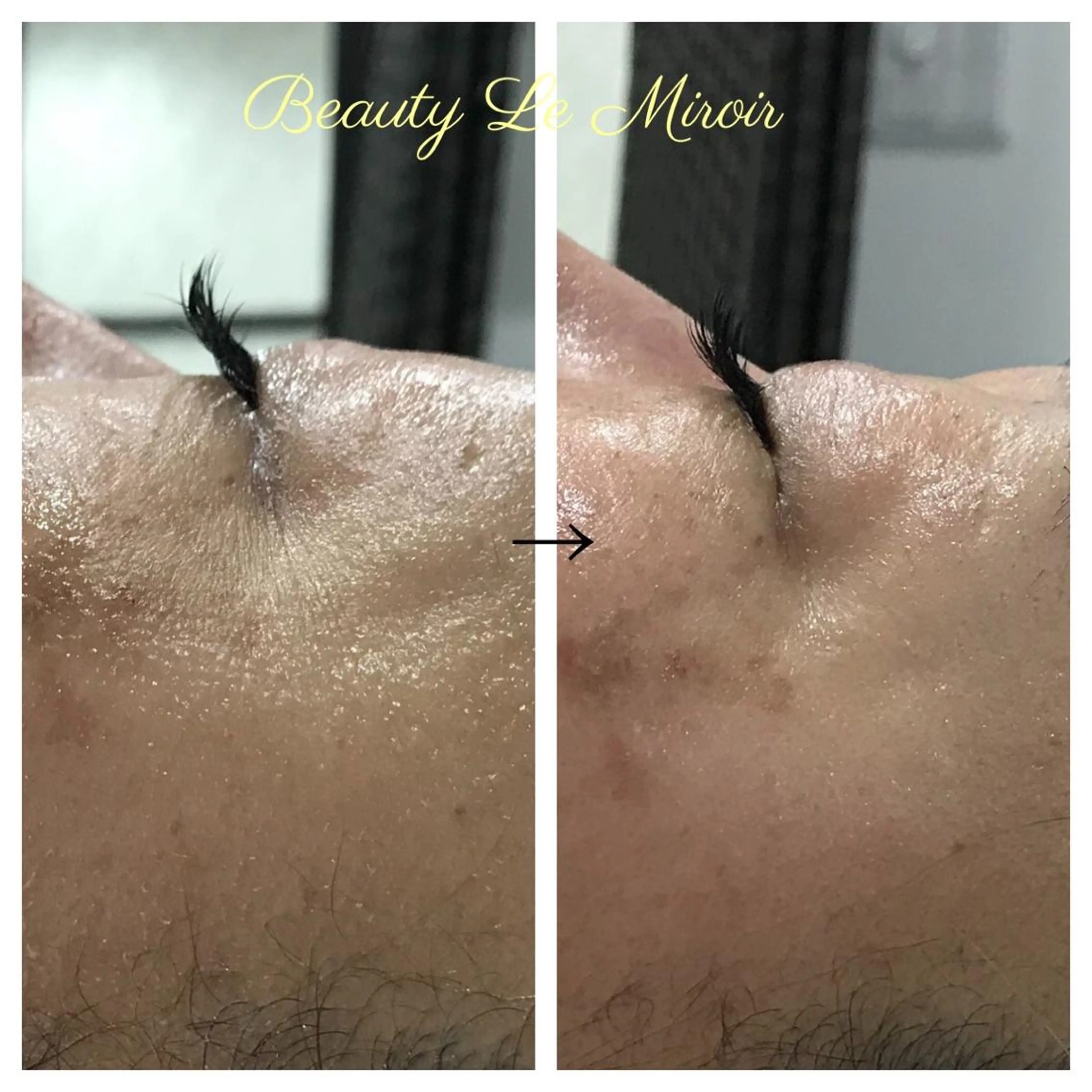 ビューティー ミロワールのエステ・リラクイメージ