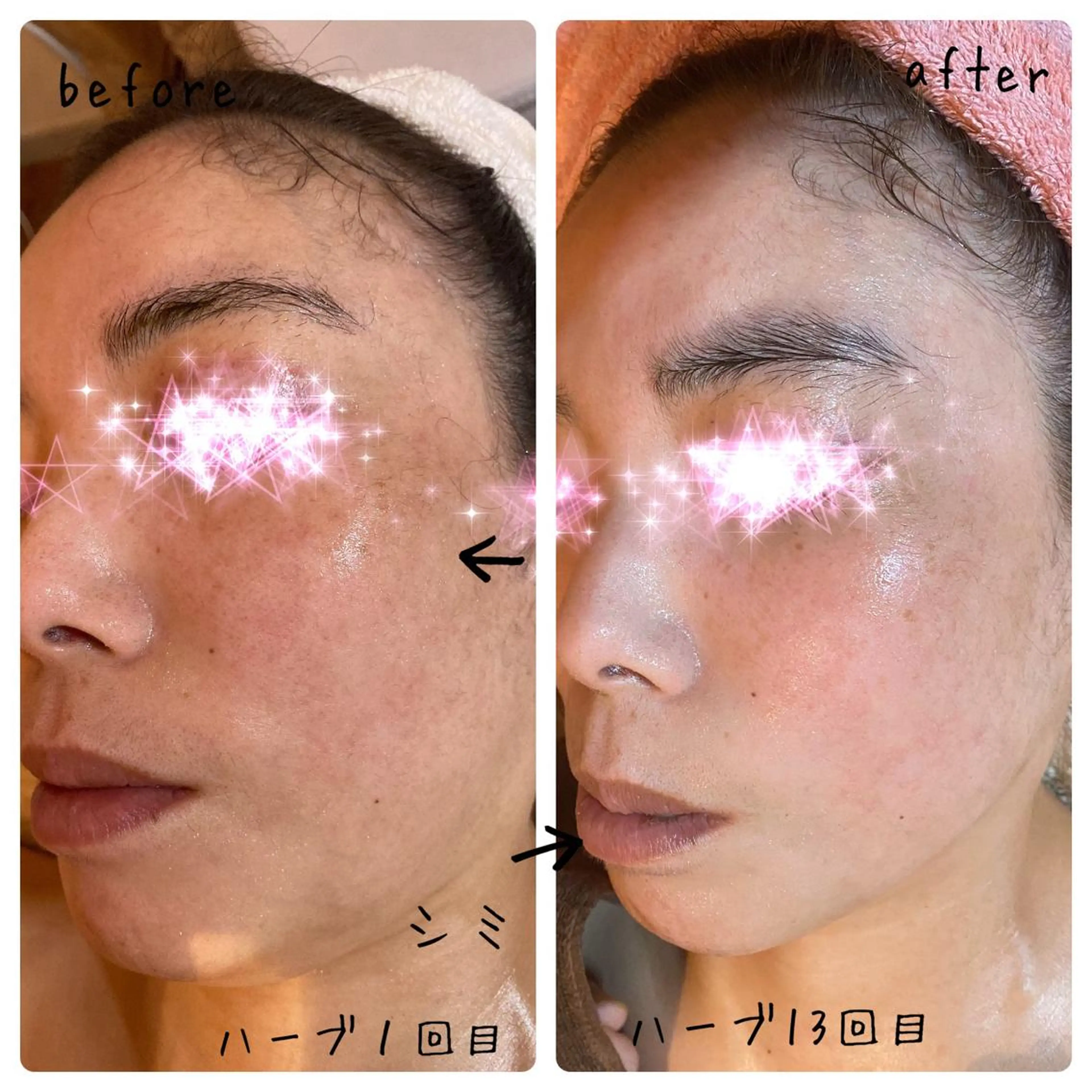 fairyrose organicエステのエステ・リラクイメージ