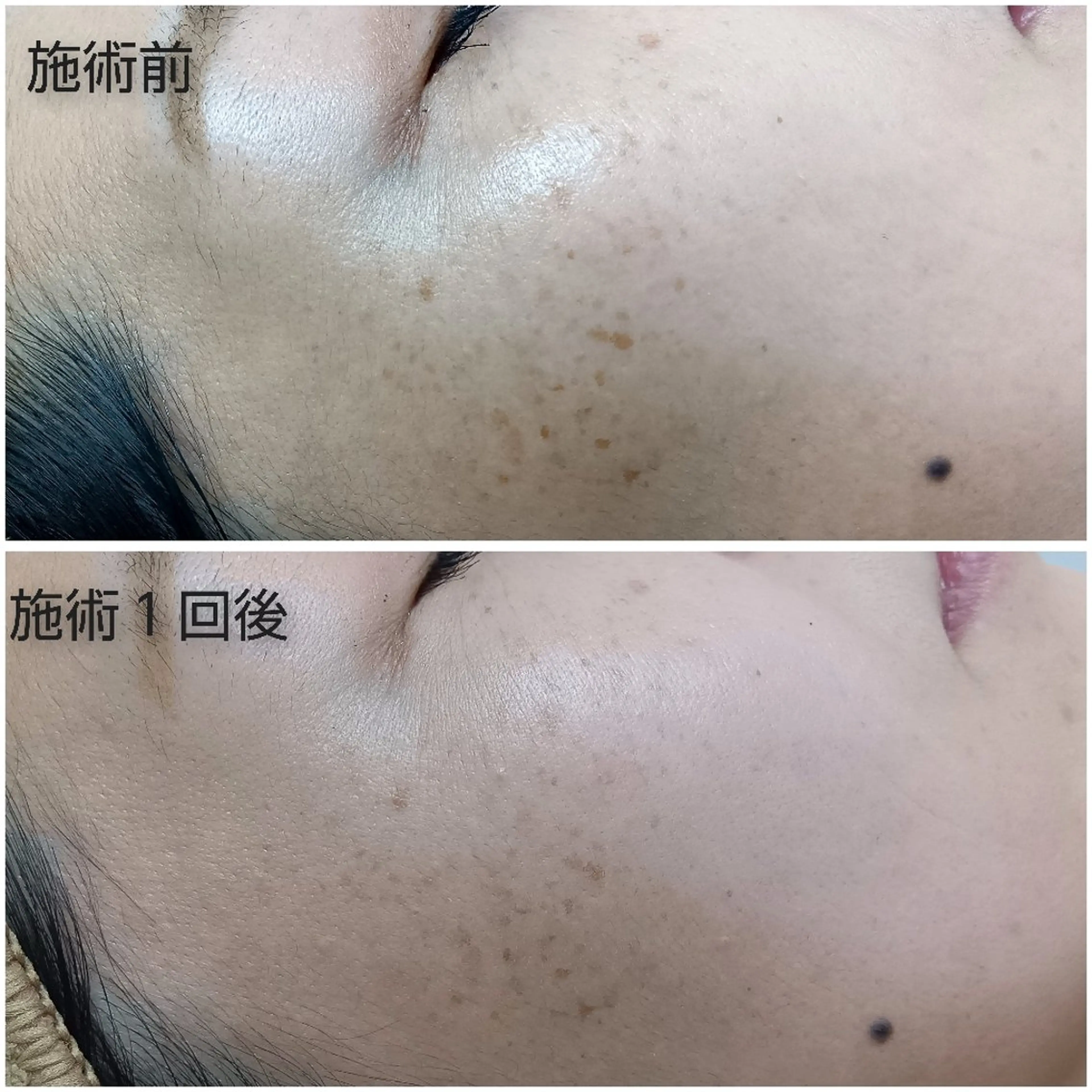 シミケア専門店 HAQUAのエステ・リラクイメージ