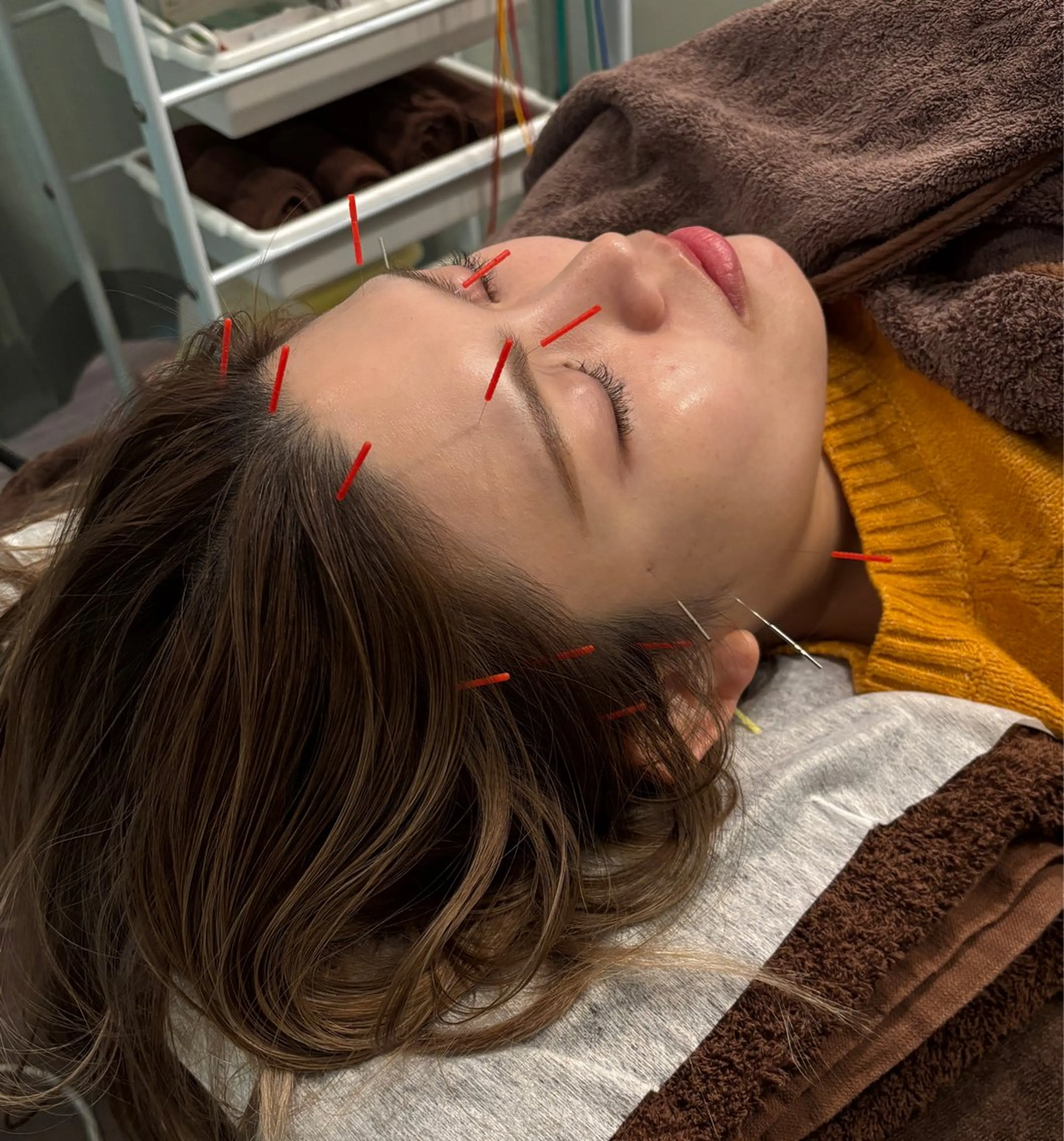 エステ リラク 小林整骨院本町 美容鍼roomのエステ・リラクイメージ