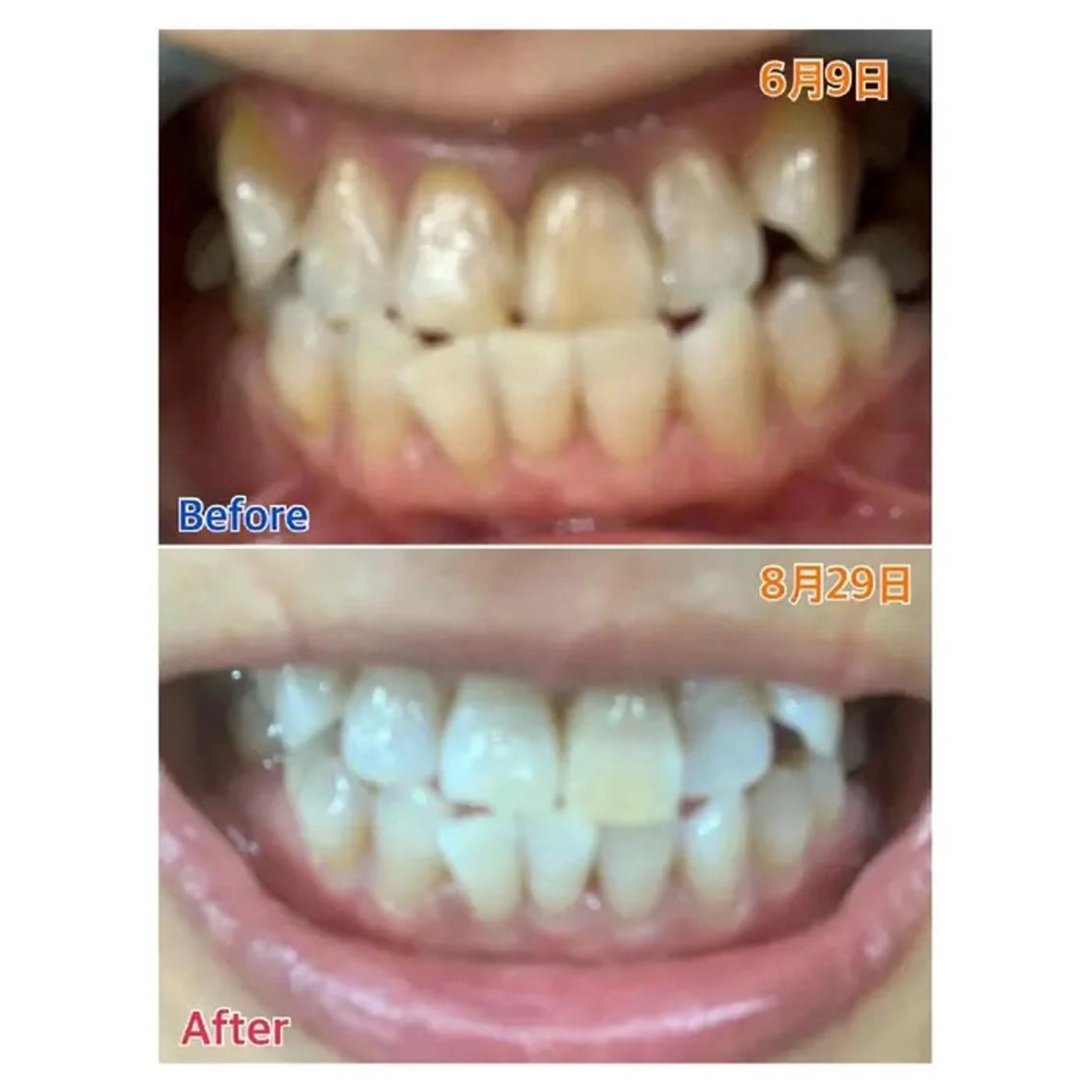 M渋谷 ホワイトニングのエステ・リラクイメージ