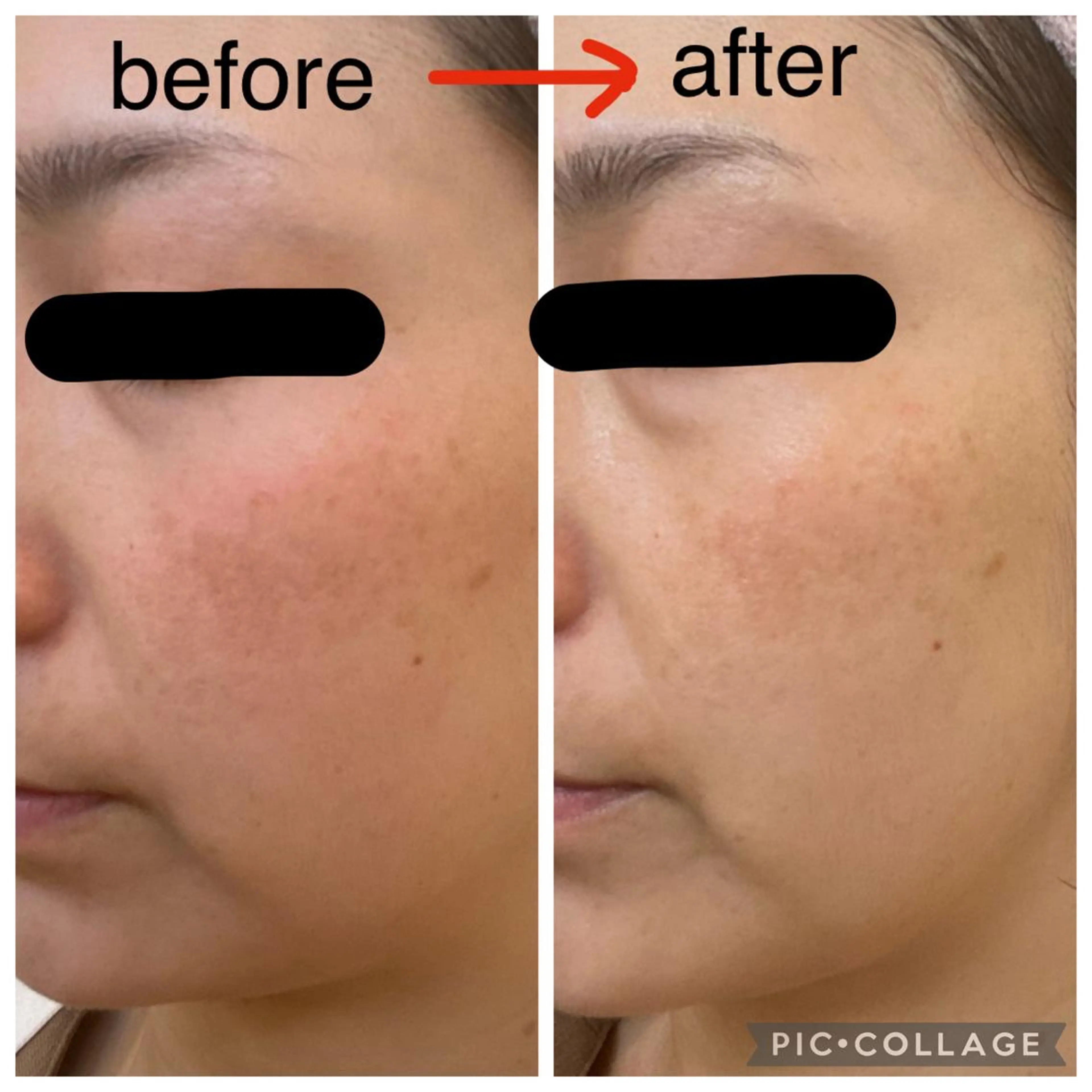 バストアップサロン -Sirius-かずのエステ・リラクイメージ