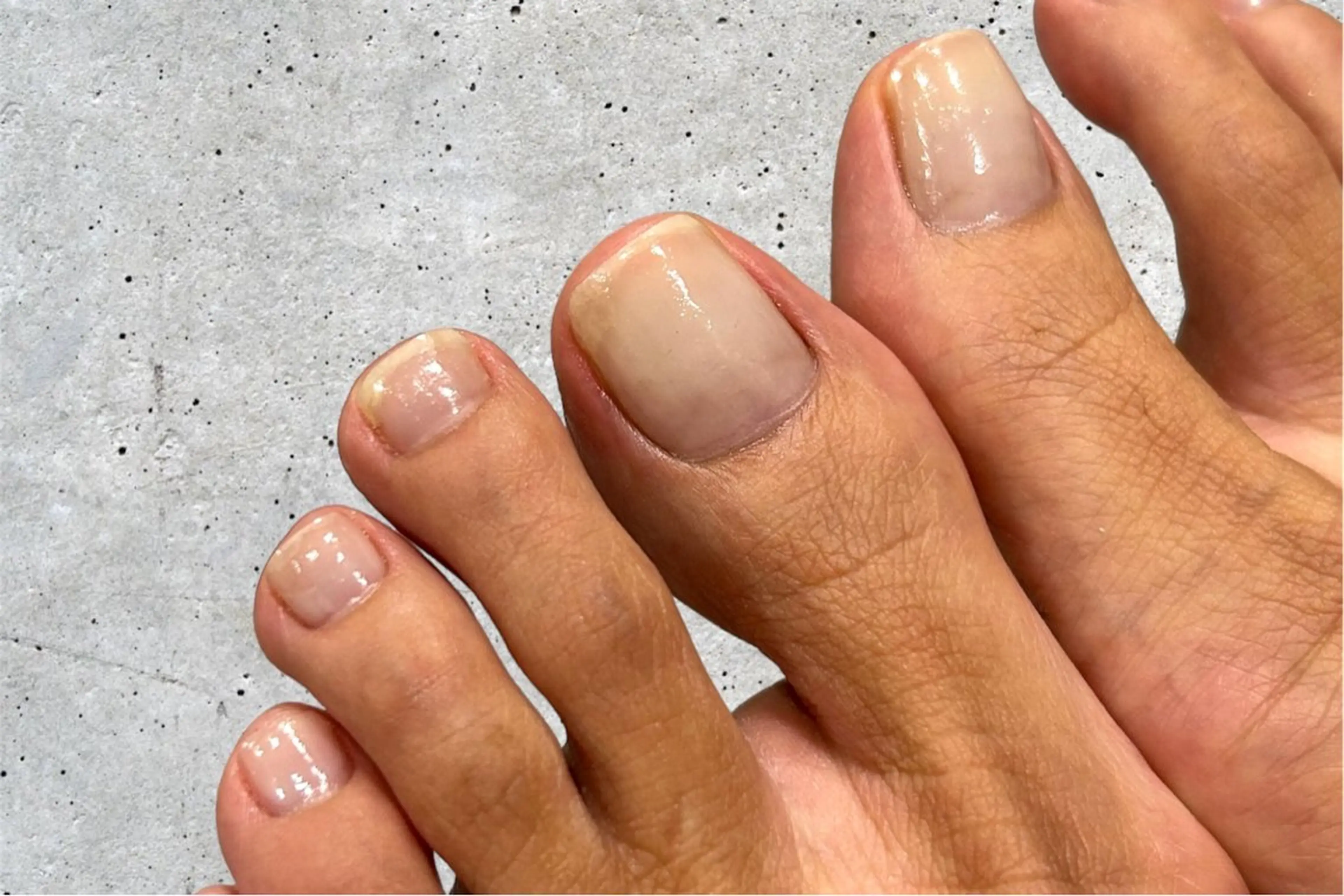 ネイル フットネイル オフのみ(ネイル) cscnail keikoのその他イメージ