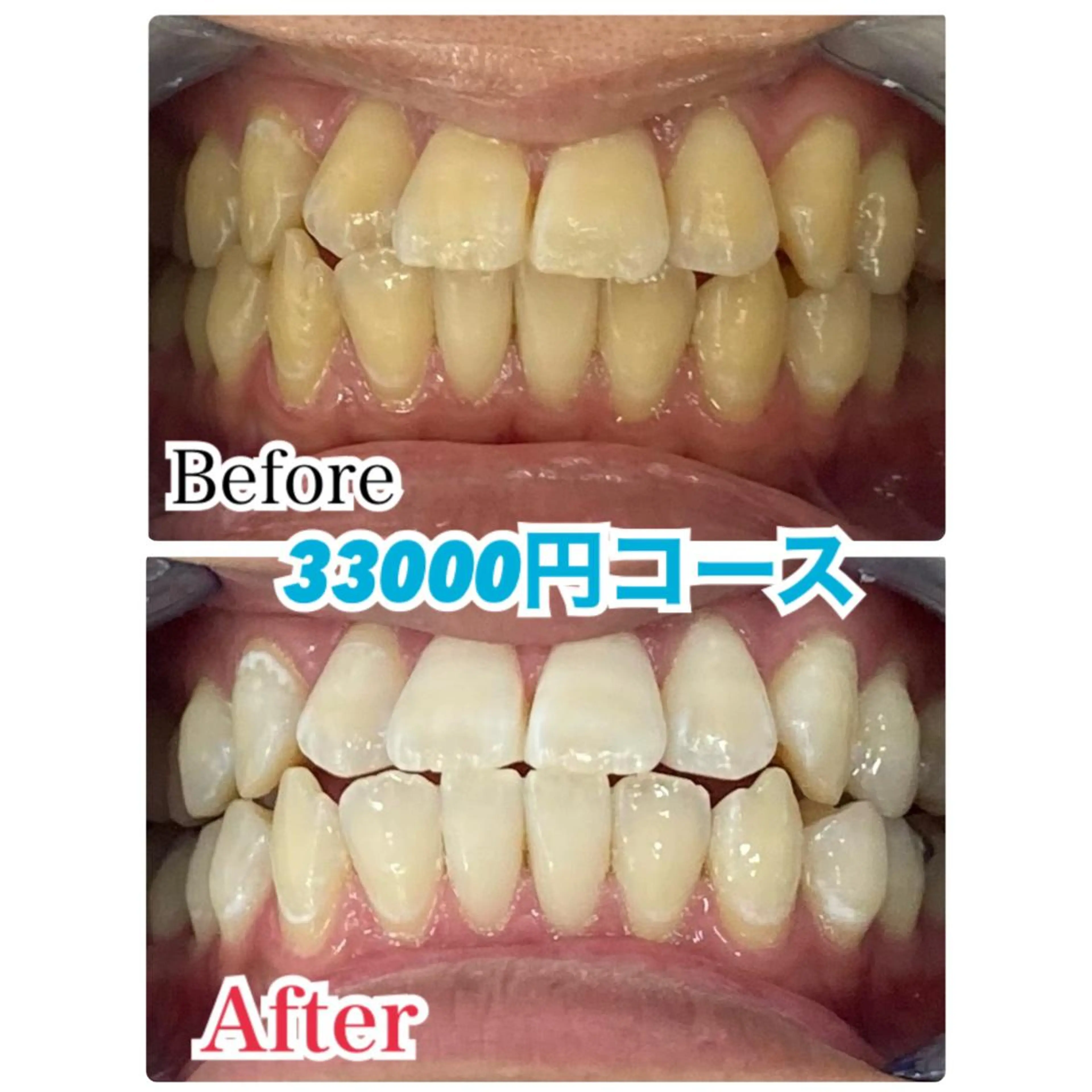 ショート ヘアアレンジ キッズ ネイル マツエク・マツパ ホワイト 【歯科提携】柏ホワイ トニングスタイルのその他イメージ