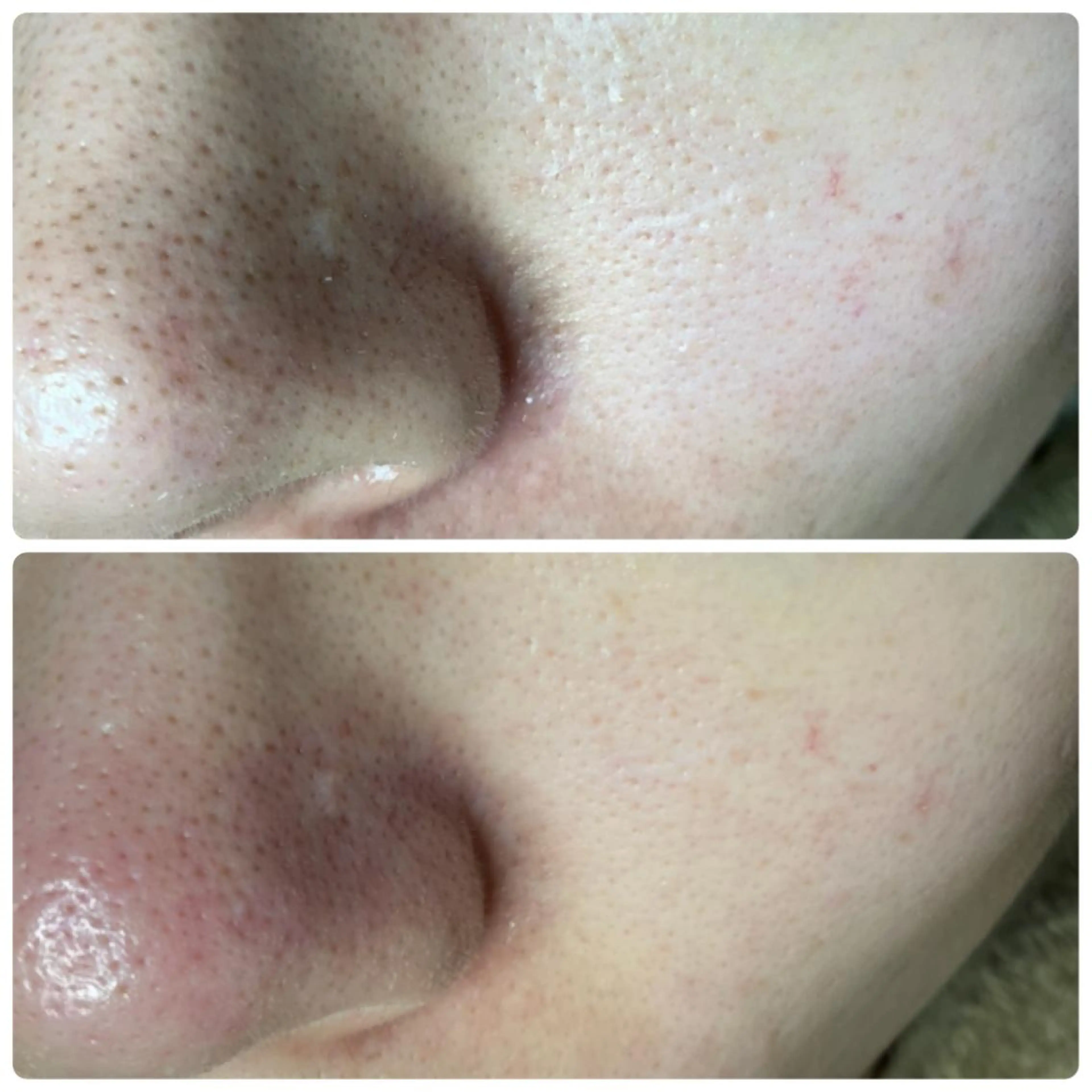 毛穴肌質ケアサロン Yourmeユアミーのエステ・リラクイメージ