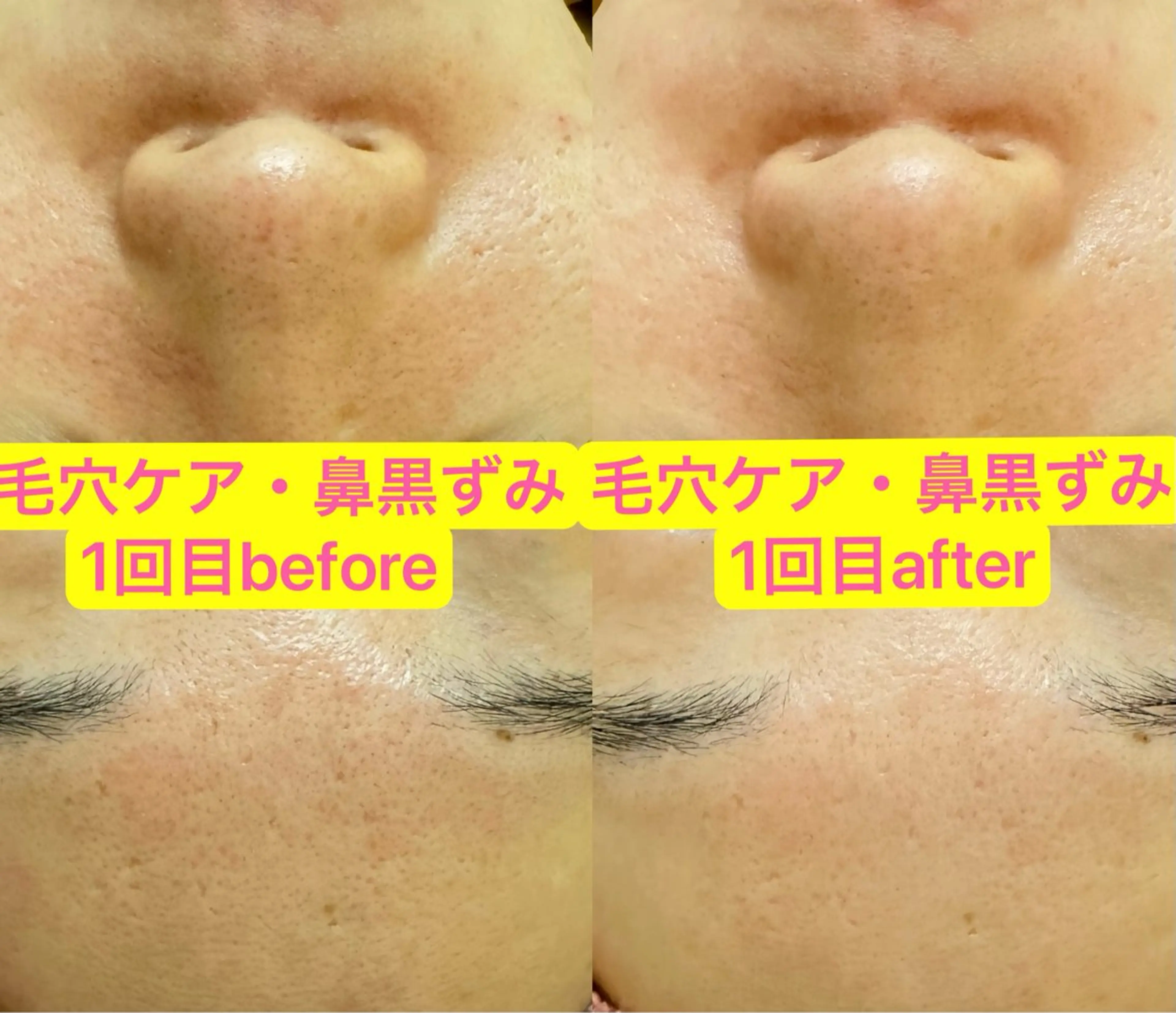 🎀エレガンテ🎀 美肌専門👸本間のその他イメージ