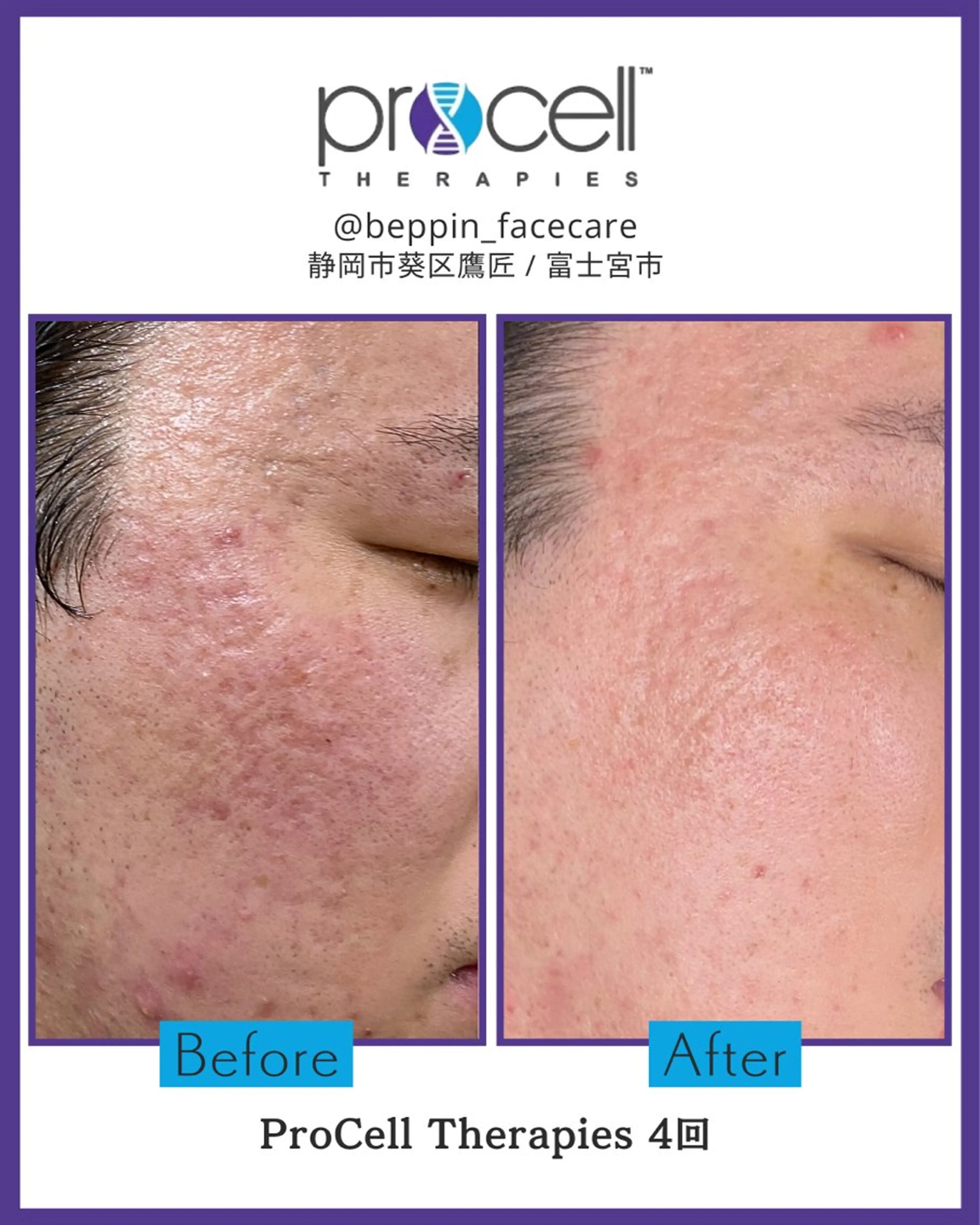 メンズ the 別嬪 静岡店所属・the 別嬪 静岡店のエステ・リラクイメージ