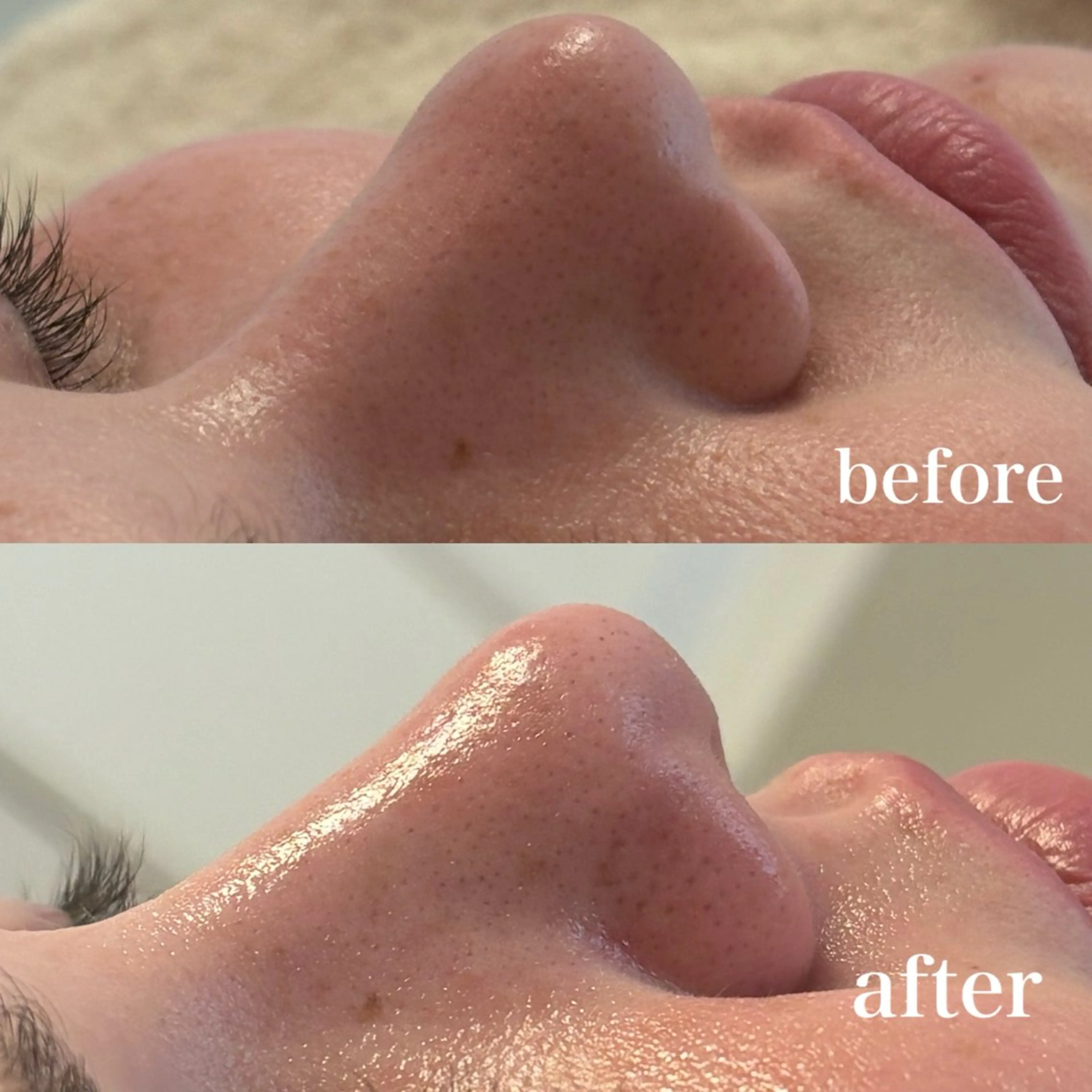 その他 美養HAREHADA 🫧/ Ibukiの眉毛・アイブロウイメージ