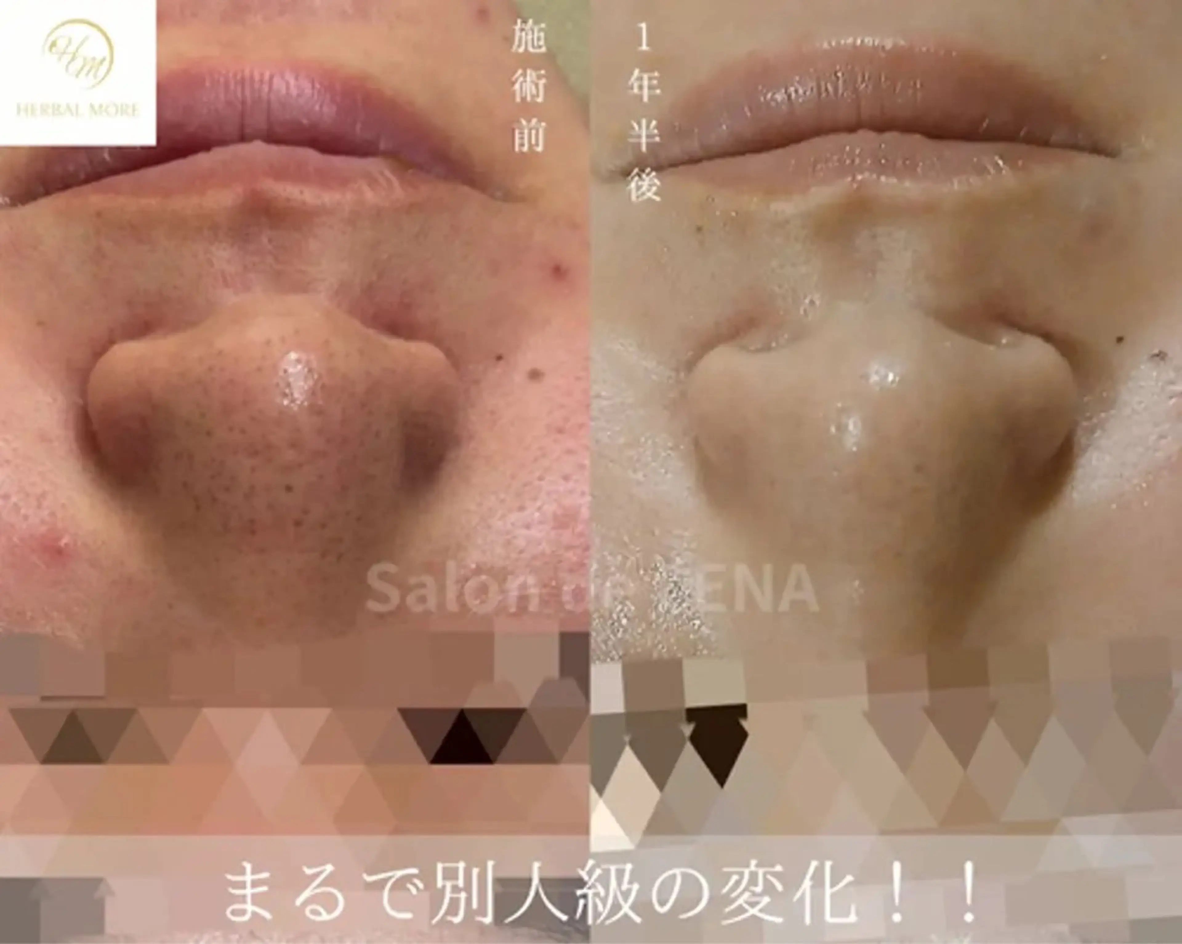 Grandir所属・ハーブピーリング専門 グランディール　武内のエステ・リラクイメージ