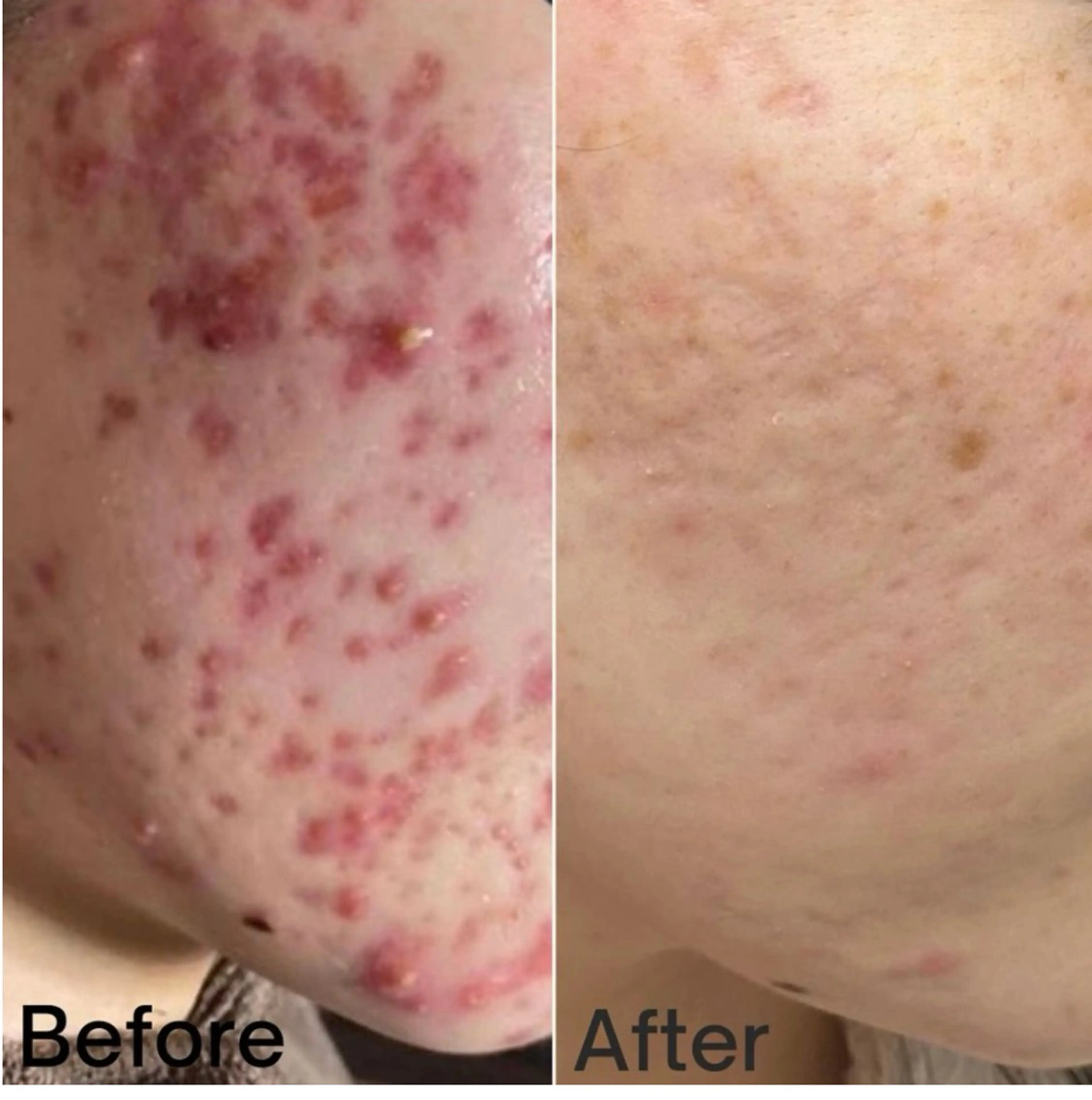 相模原/毛穴/ニキビ フェイシャルRikoのエステ・リラクイメージ