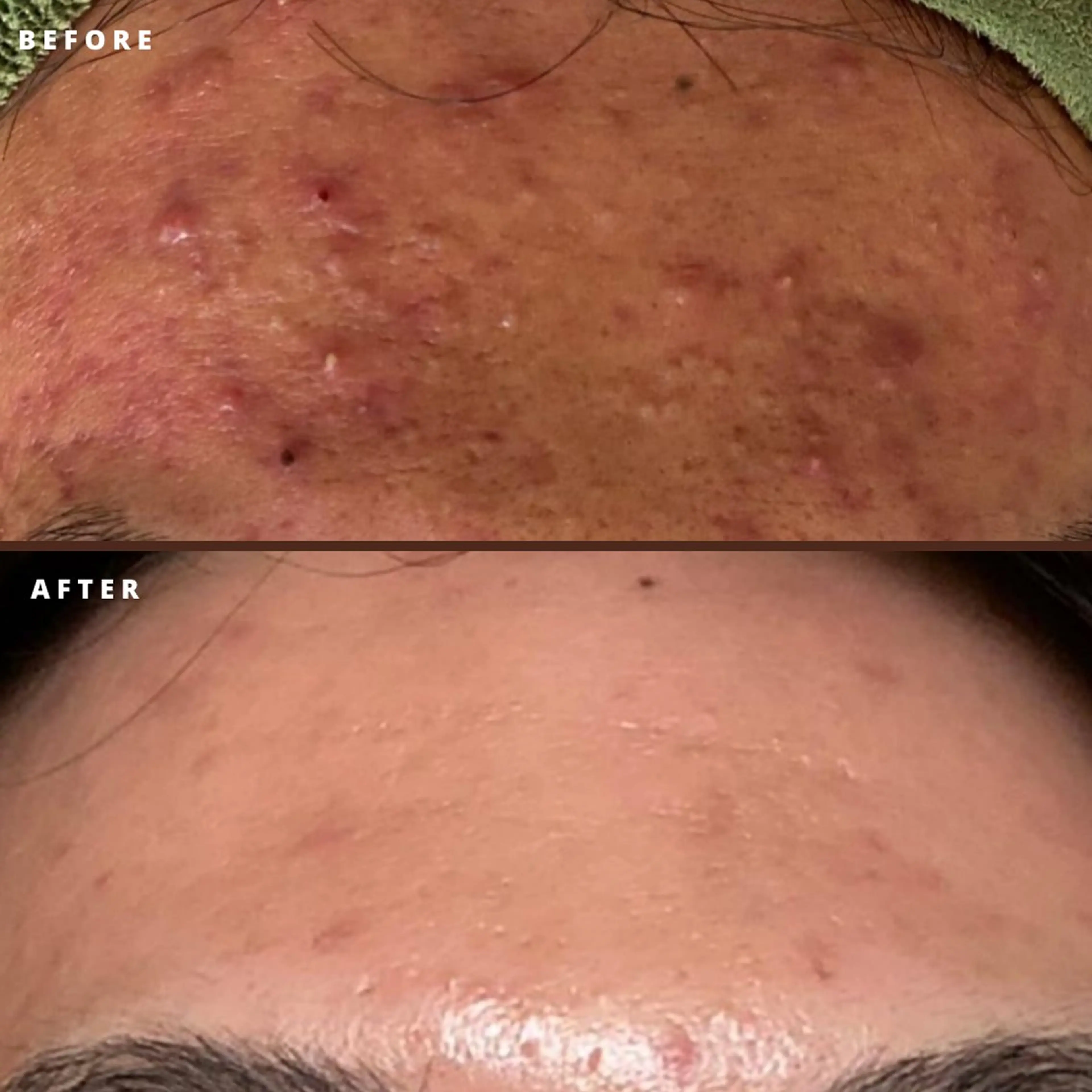 毛穴改善サロン d'Alba大阪住吉のエステ・リラクイメージ