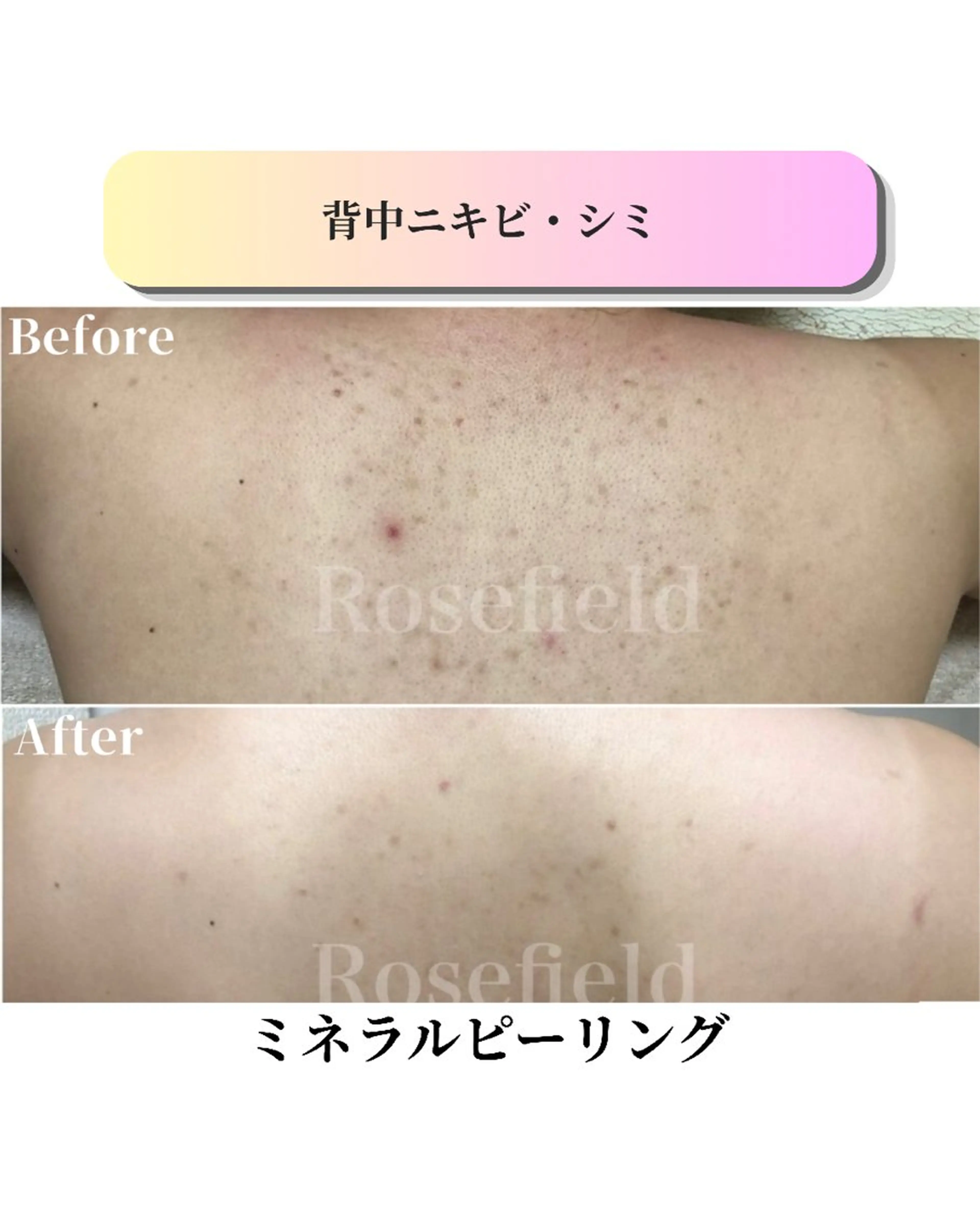 エステ ローズフィールド 森岡朋美のエステ・リラクイメージ