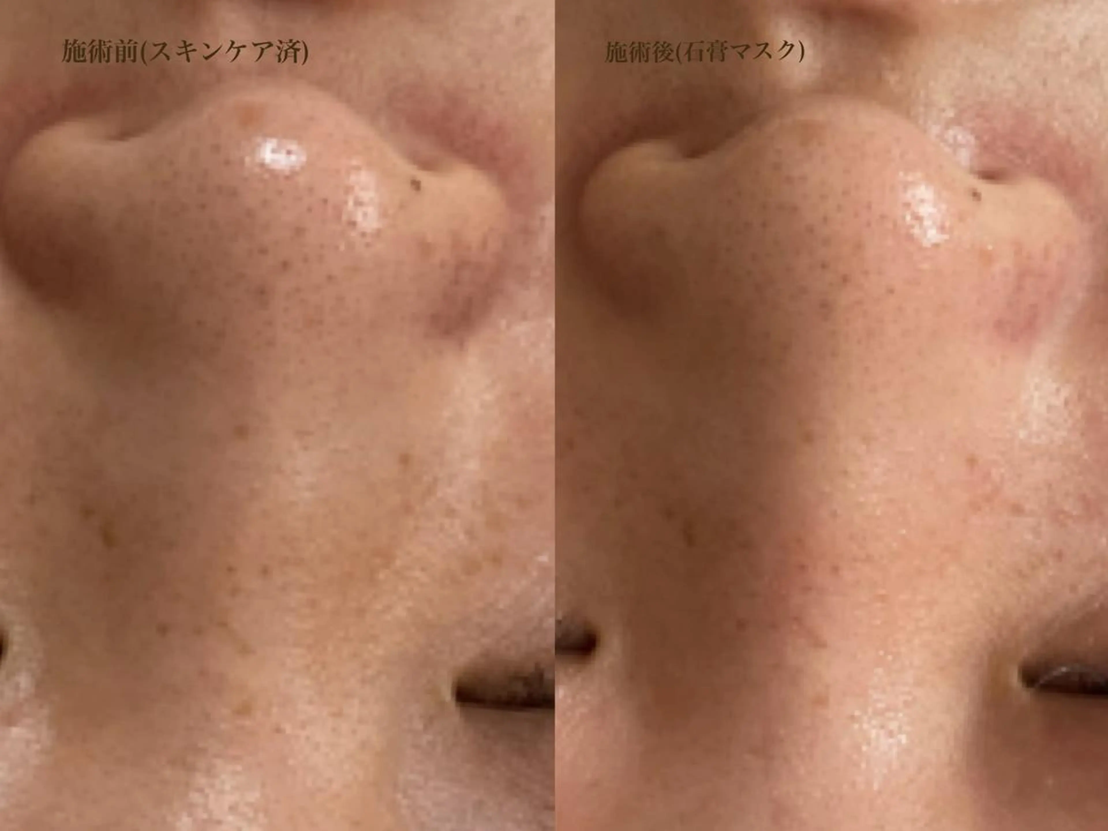 森口 美空のエステ・リラクイメージ