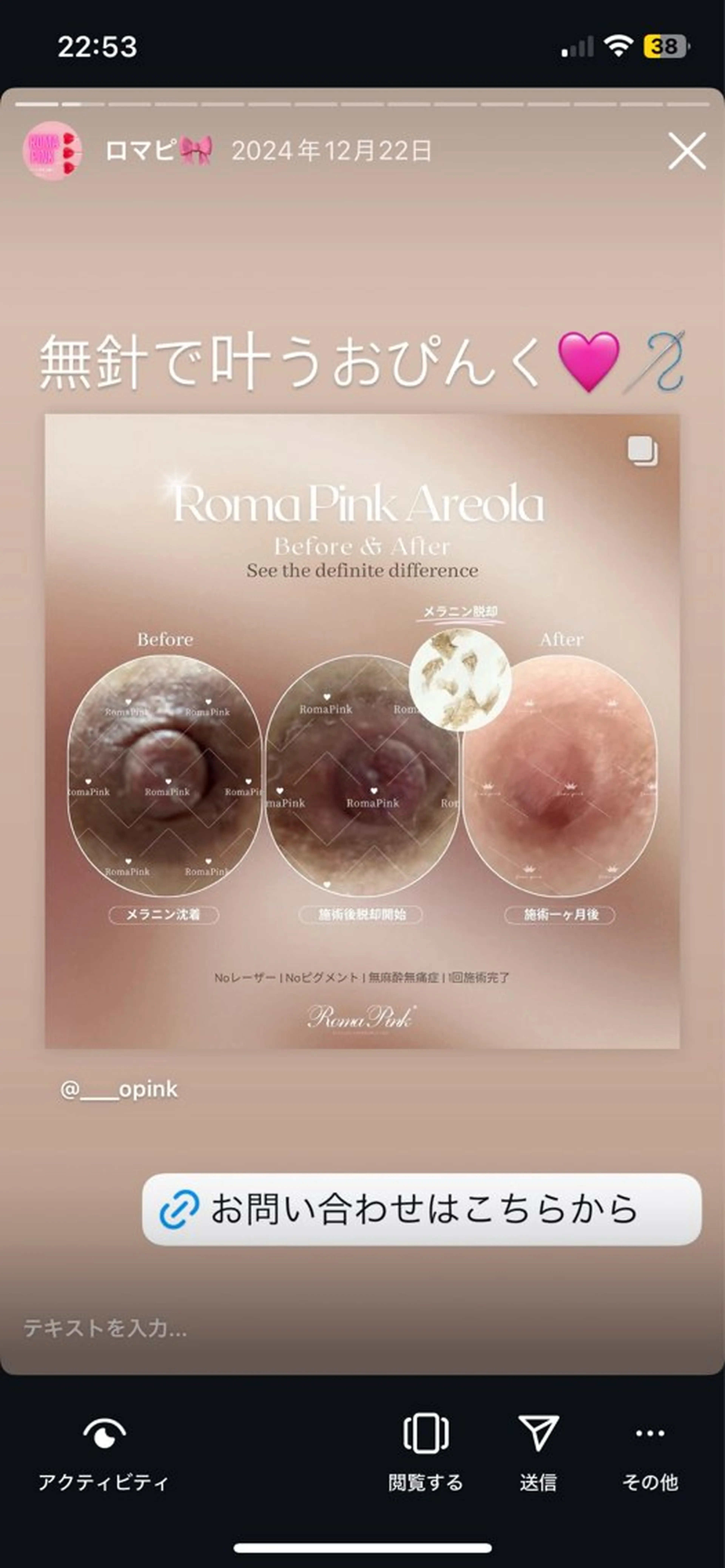 美人スイッチdiet スーパージェクションのその他イメージ