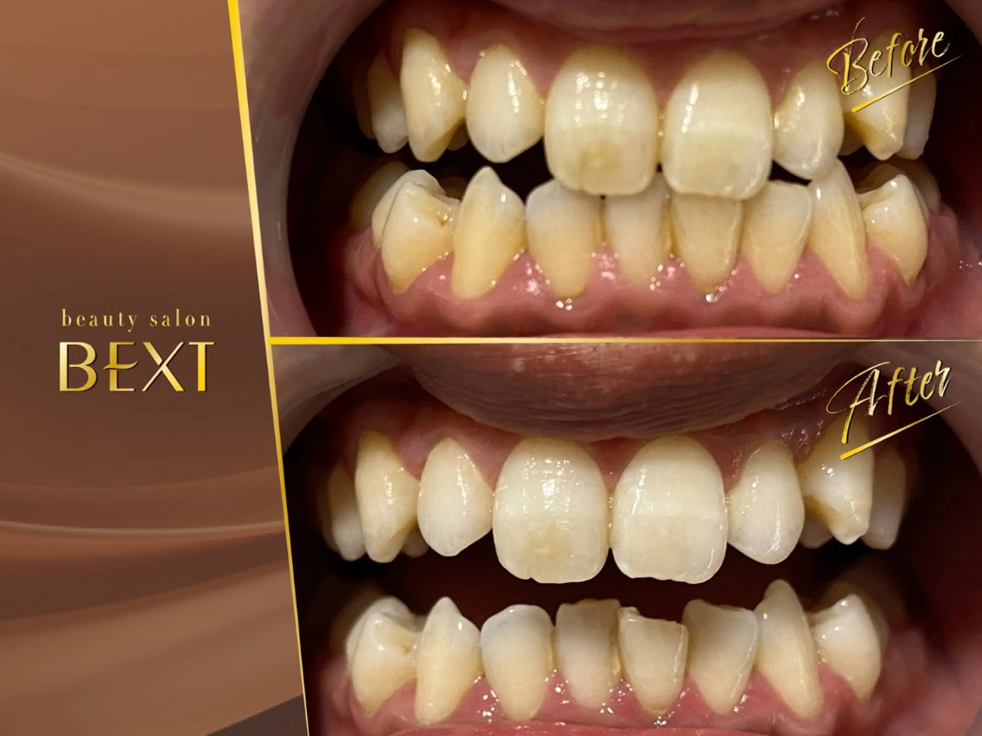 メンズ エステ リラク ビューティーサロン ベクスト名古屋のマツエク・マツパデザイン