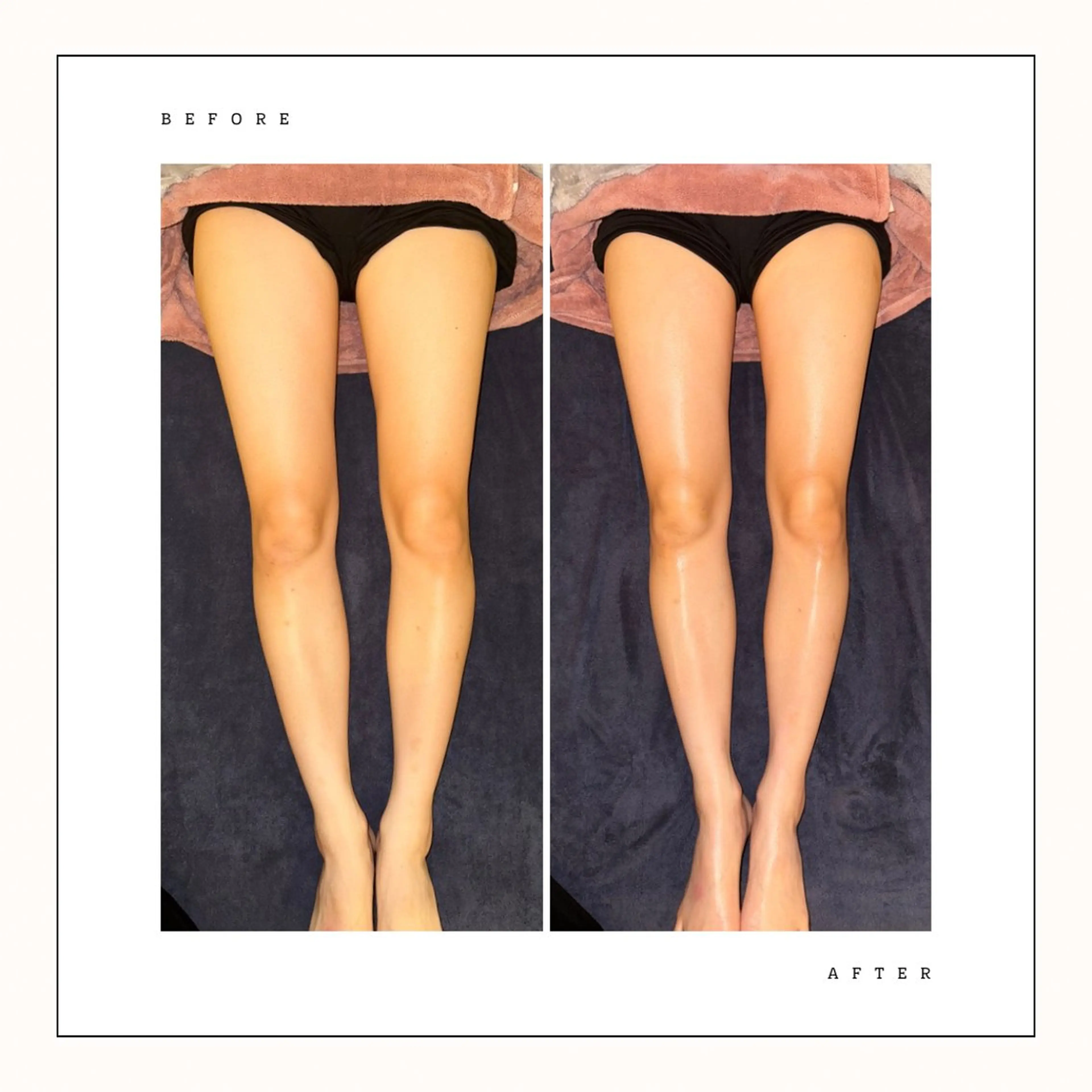 SHARES ERIのエステ・リラクイメージ