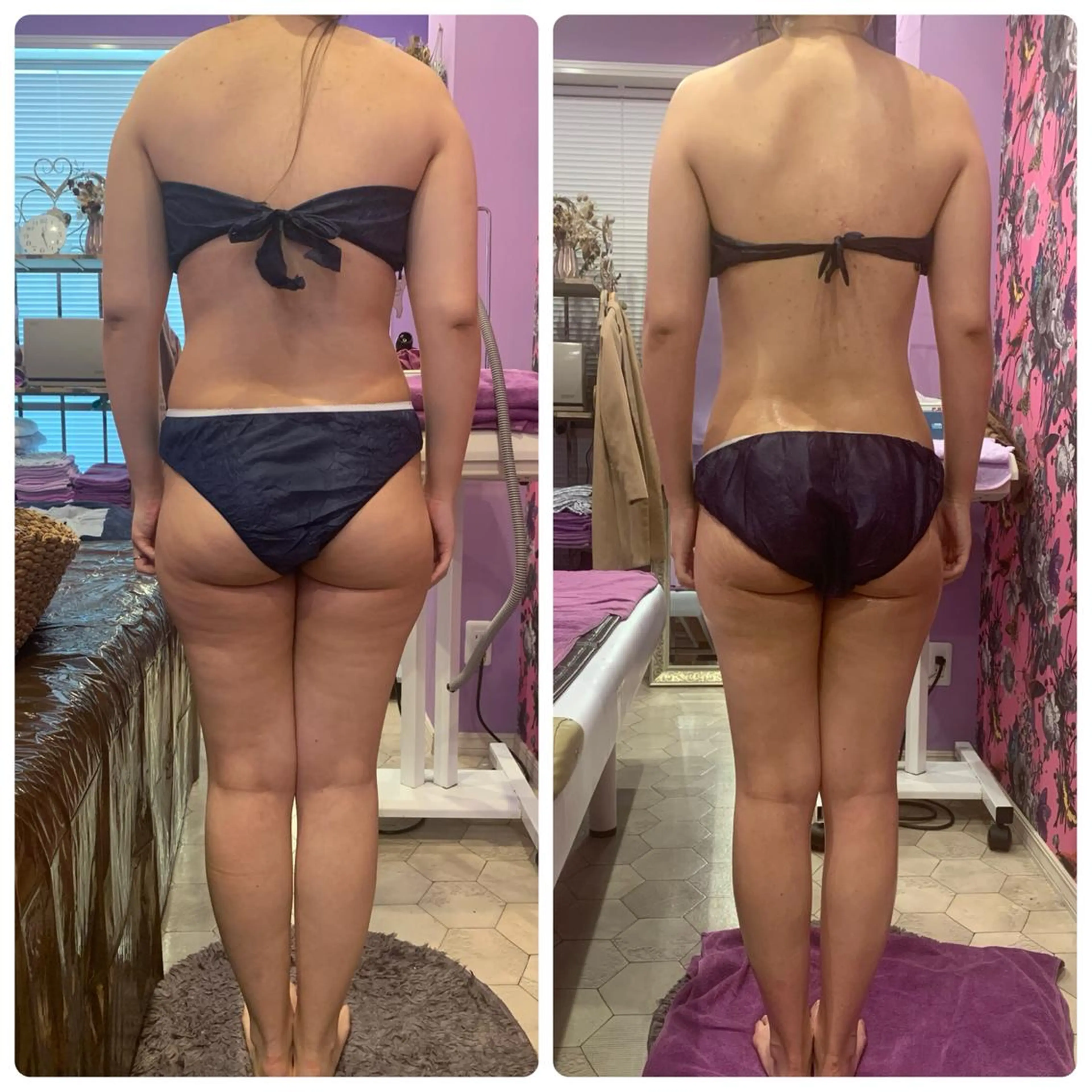 10周年キャンペーン★初回限定P.R.CELLとオイルマッサージのセットコース90分の写真