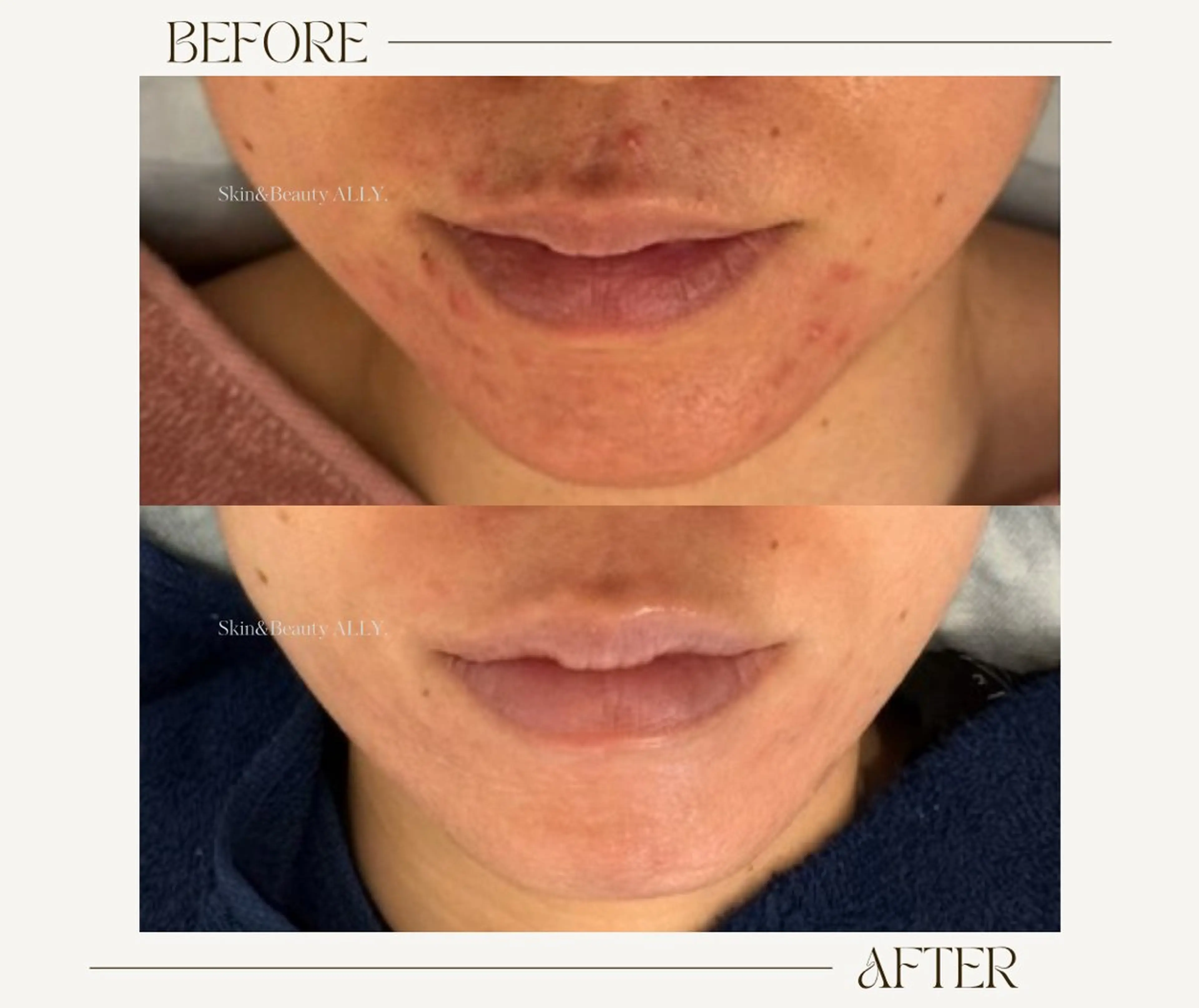 エステ 艶肌ワックス ALLY.のエステ・リラクイメージ