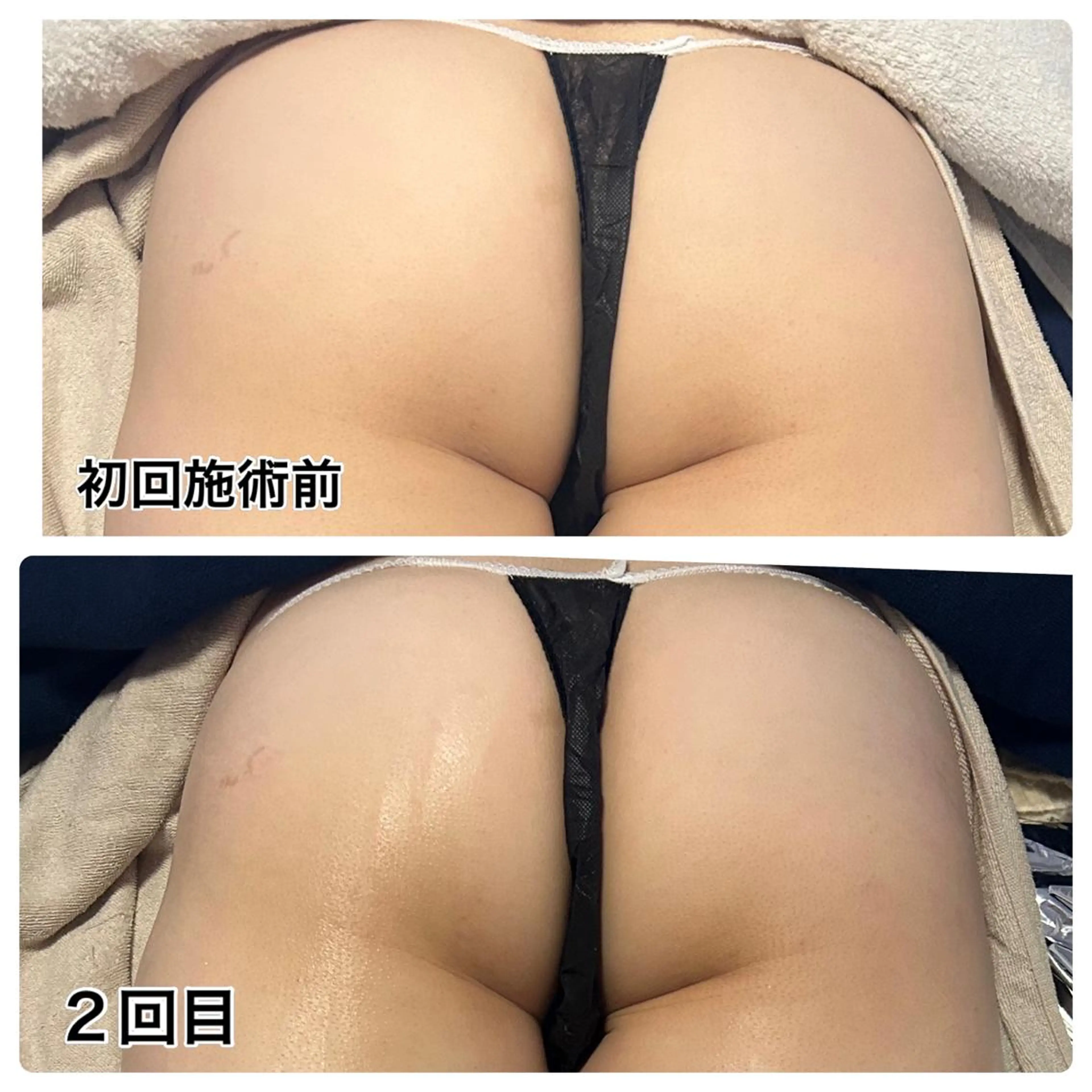 🌴Beauty Salon LANAのエステ・リラクイメージ