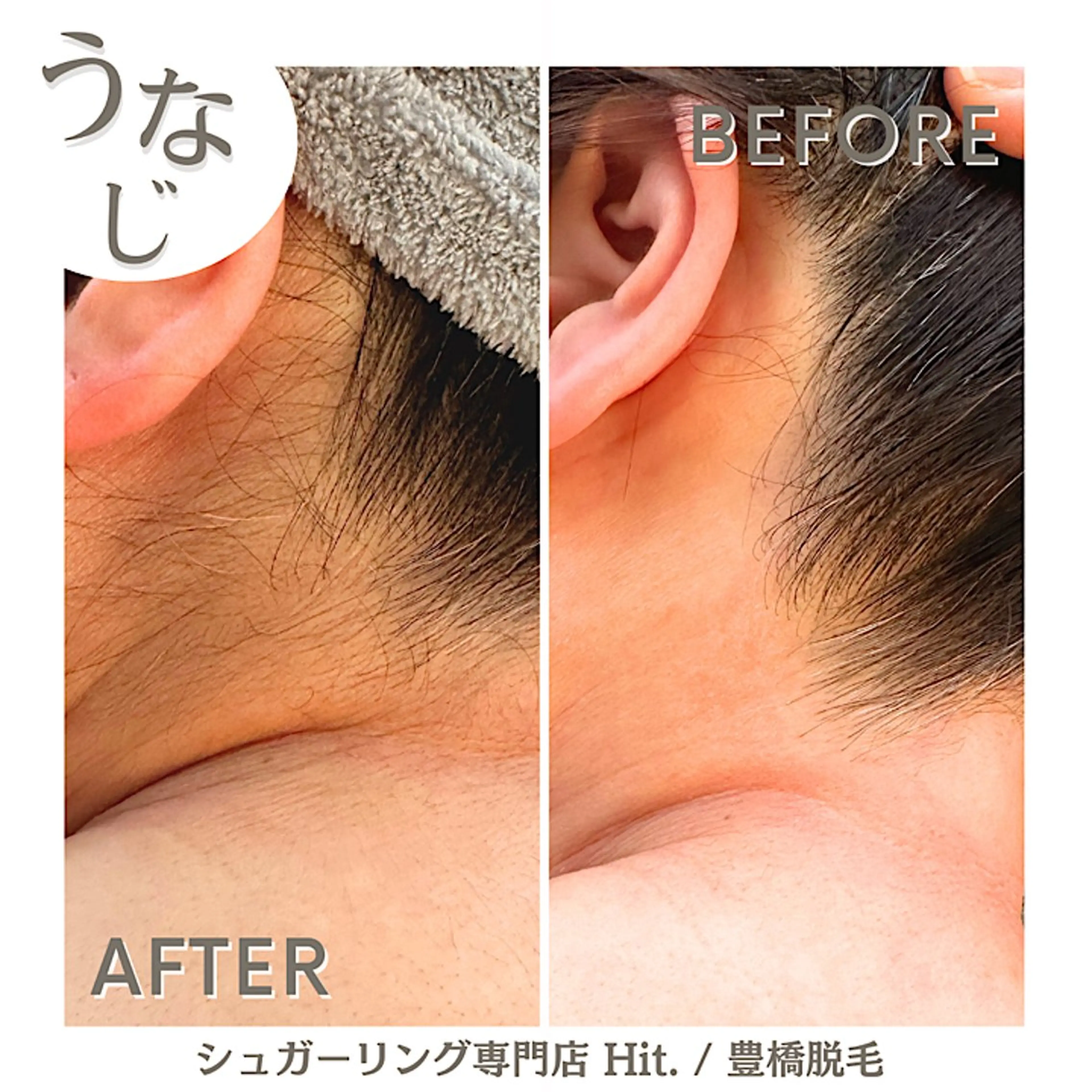 Hitomi シュガーリング豊橋のその他イメージ