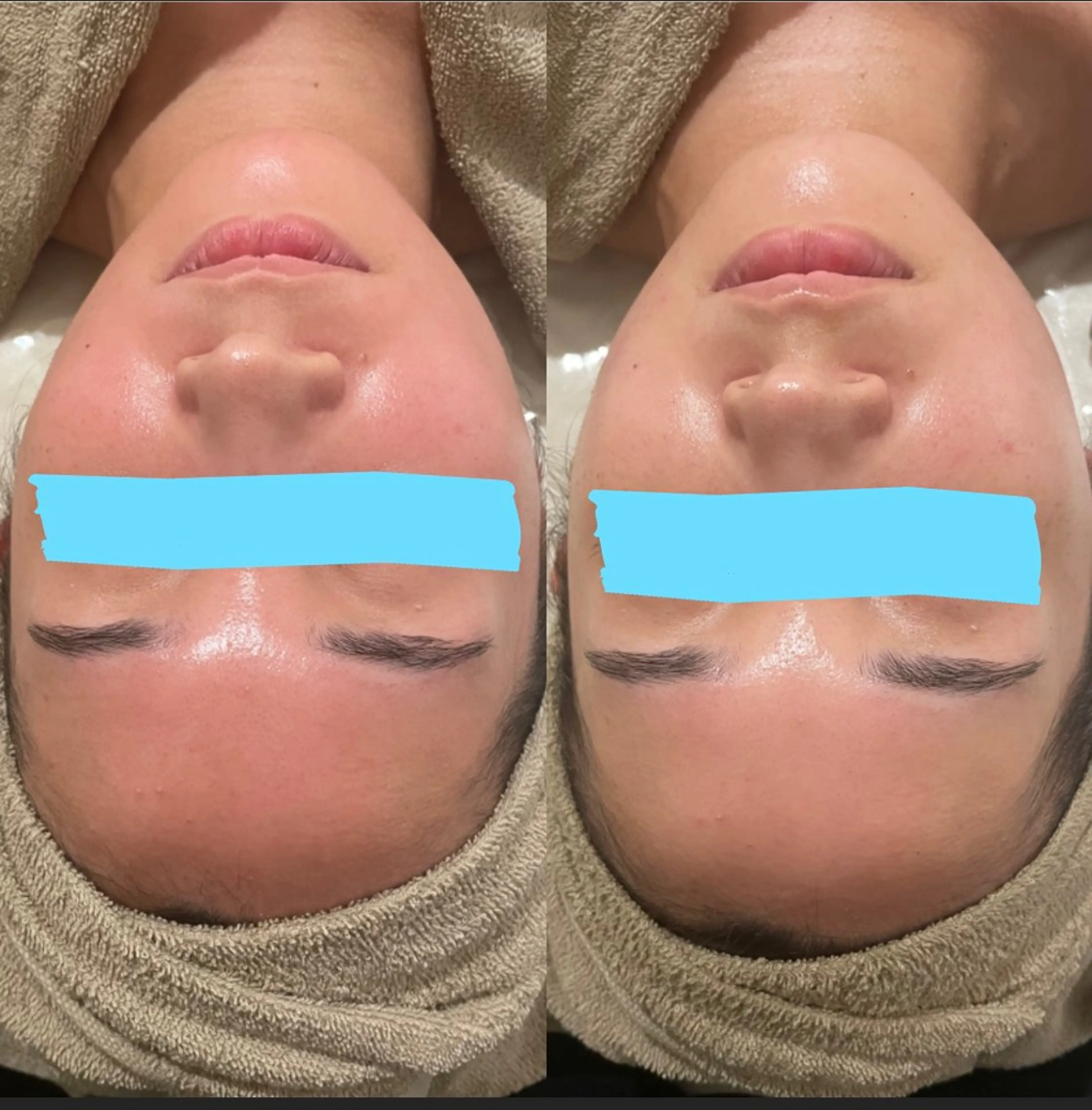 中目黒ハーブピーリン グ🌿ララピールのエステ・リラクイメージ