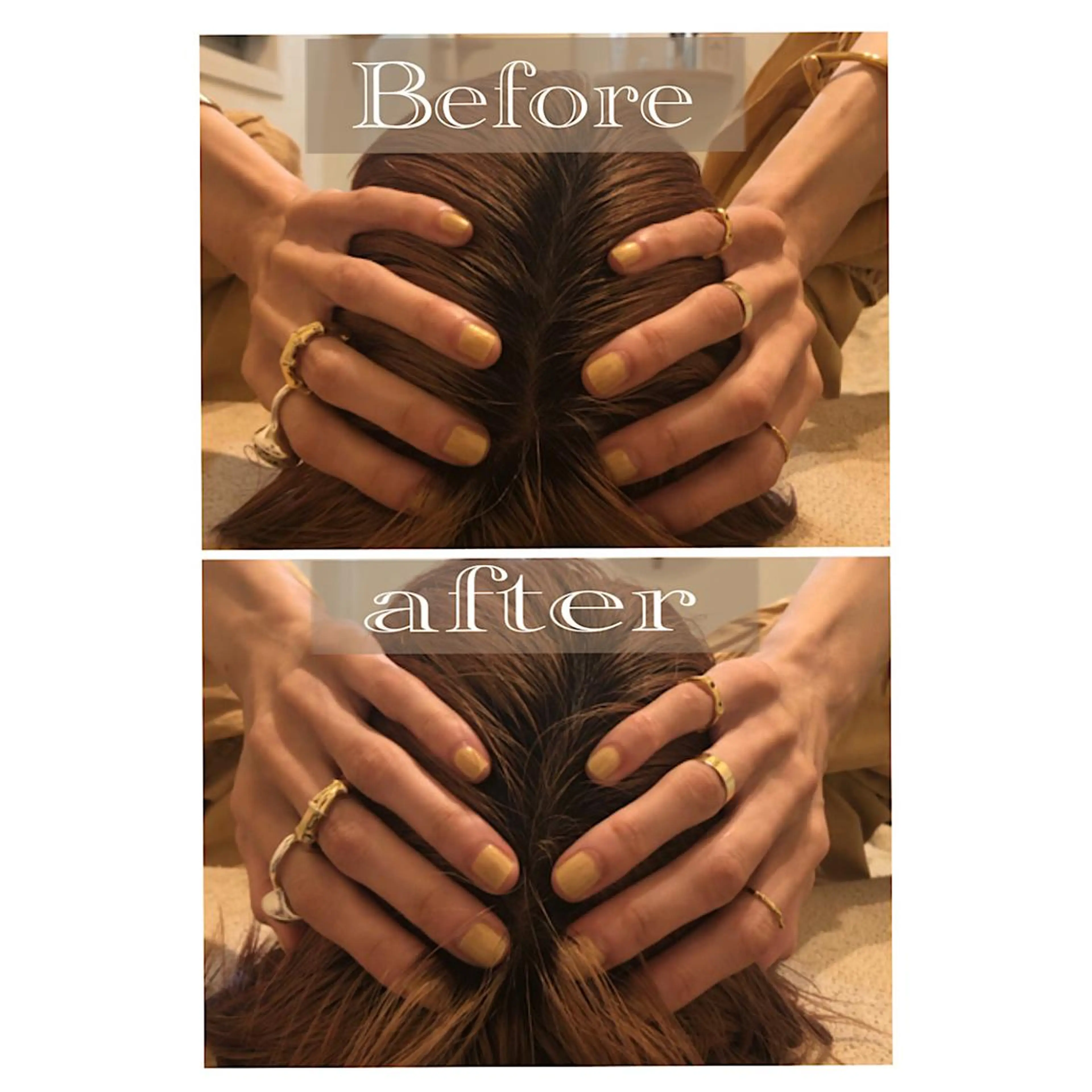 鍼灸 Refineのその他イメージ