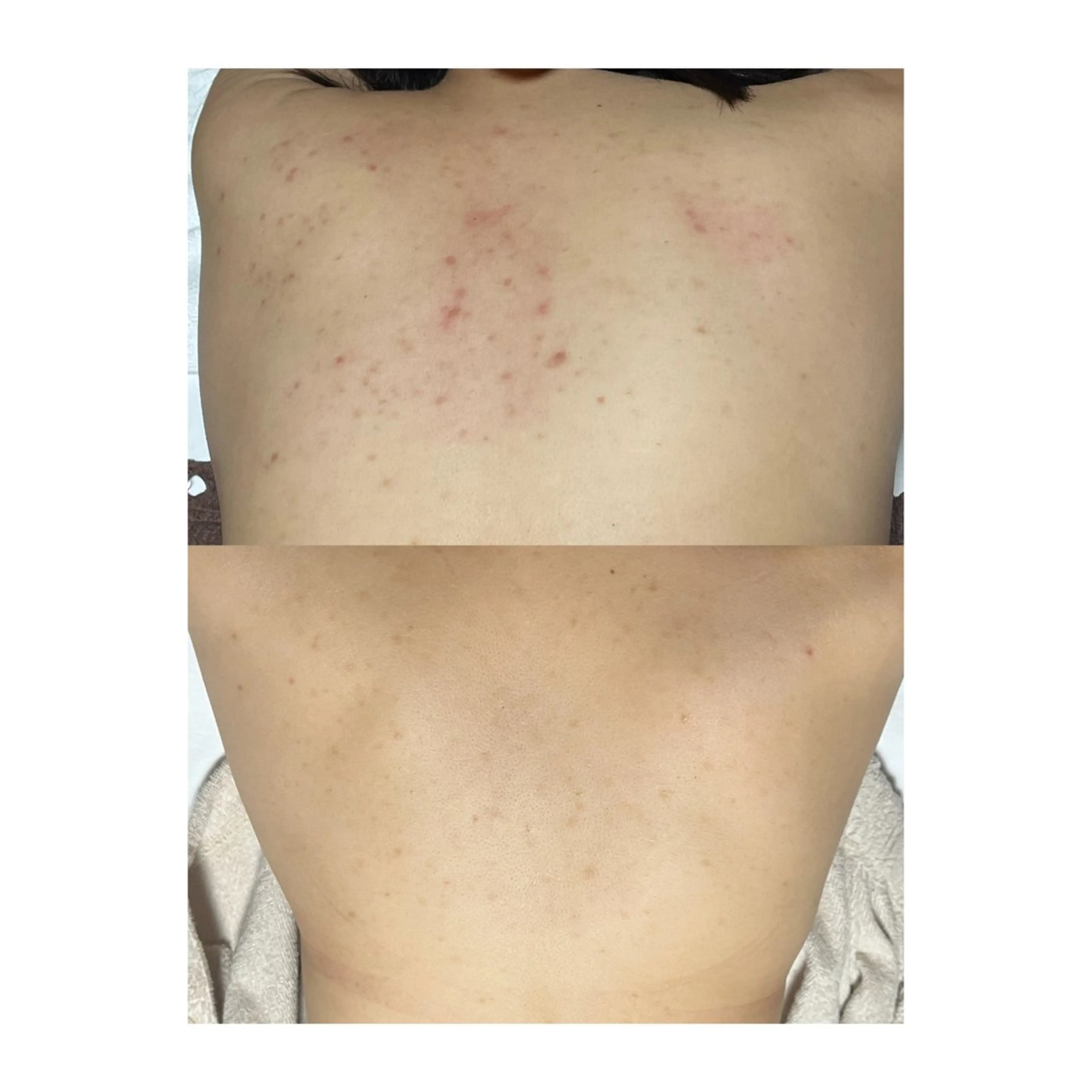 y2k SALONのエステ・リラクイメージ