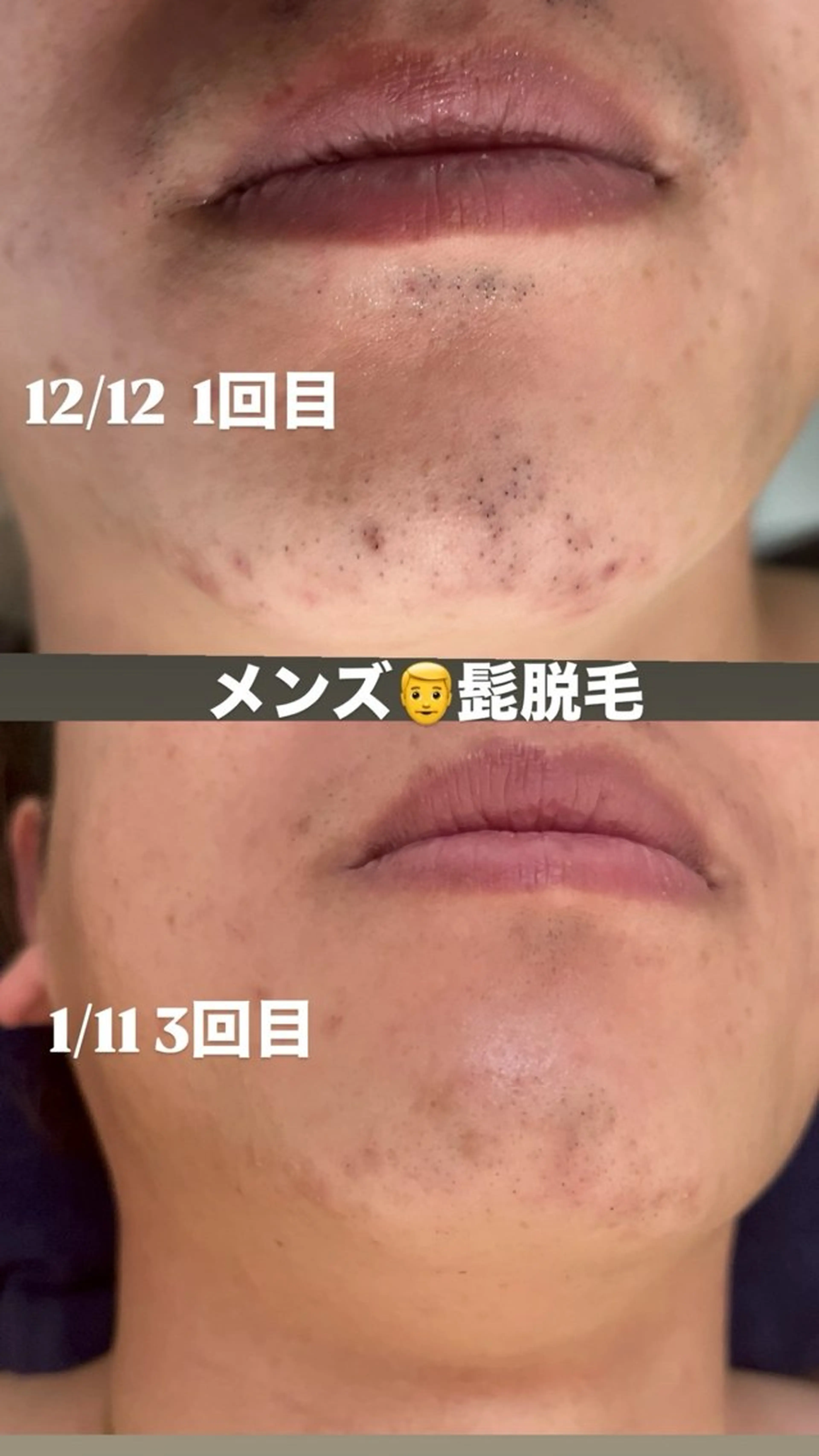 トータルビューティーサロンFirstclass所属・Firstclass Erikaのエステ・リラクイメージ