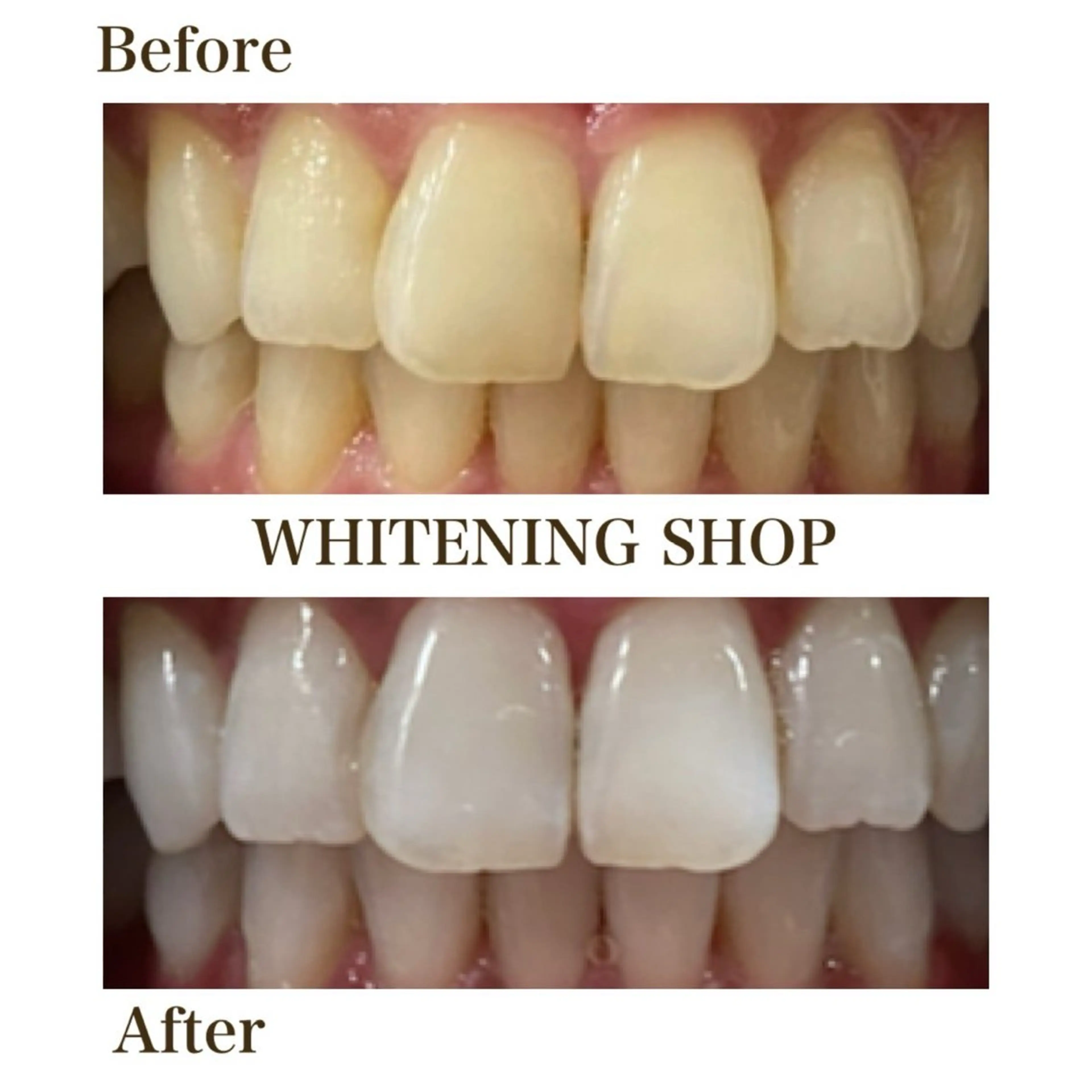 ホワイトニングショップ静岡葵区店所属・ホワイトニング ショップ葵区静岡駅店のその他イメージ