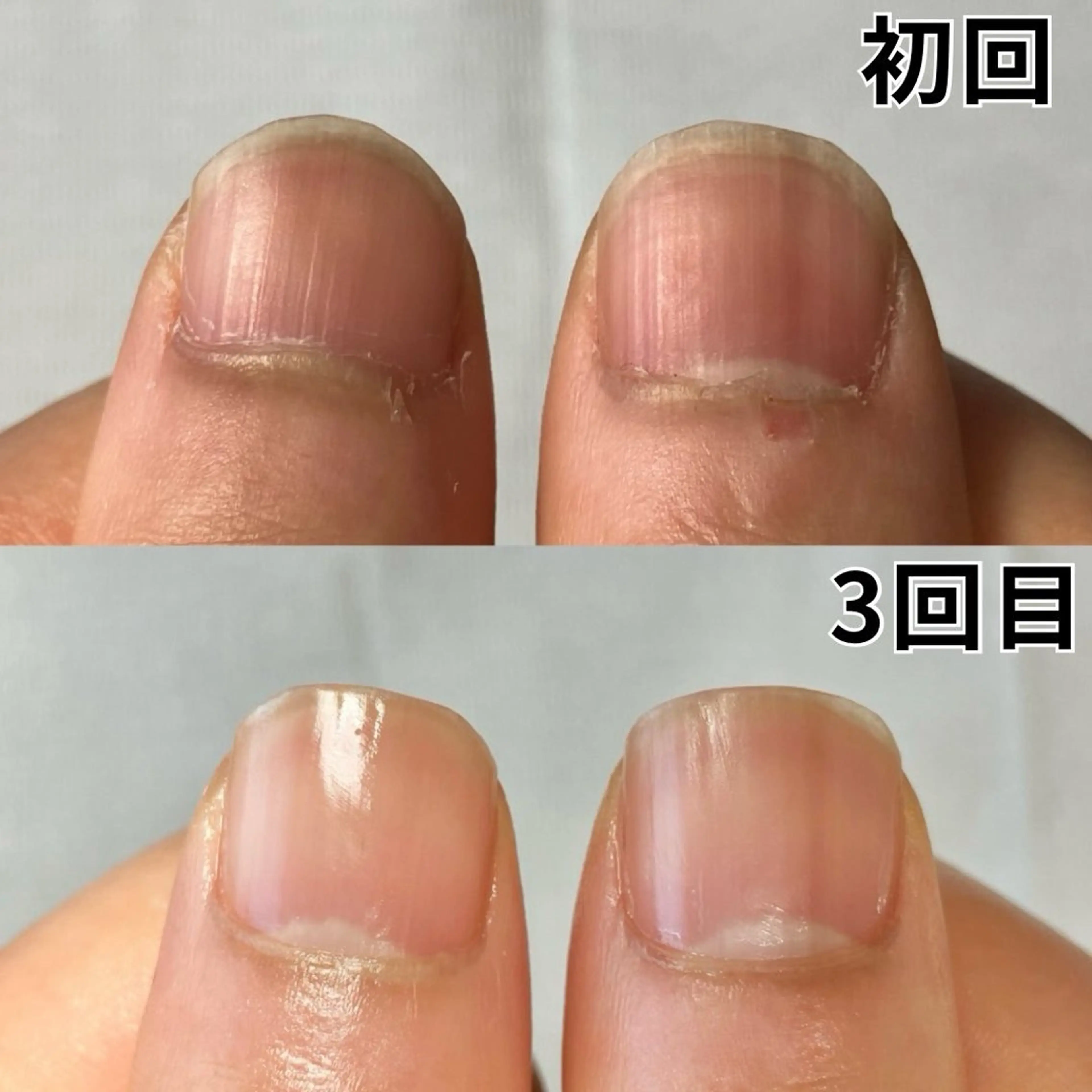 ネイル 高木 みどりのネイルデザイン