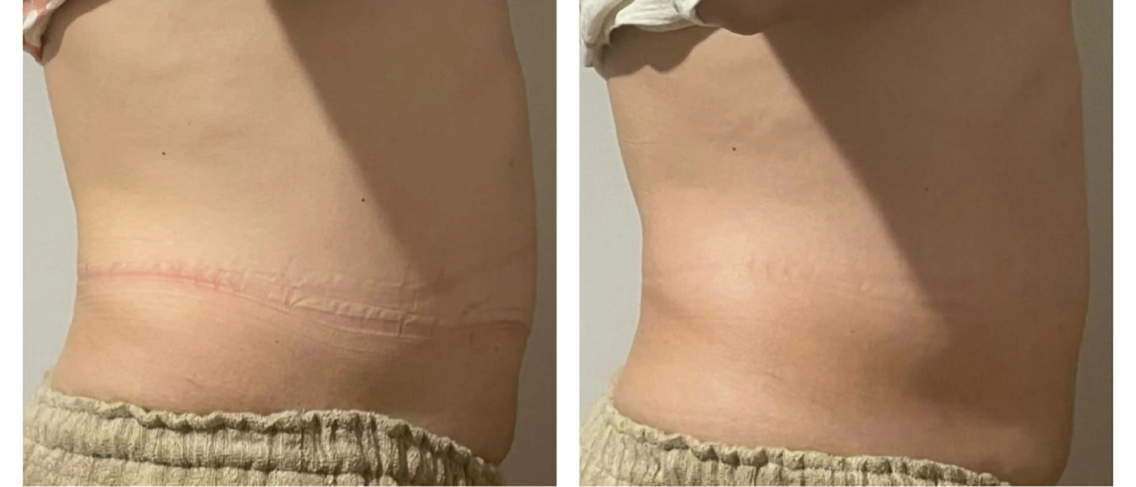 エステ 癒し腸もみサロン シャユーム　ゆきなのエステ・リラクイメージ