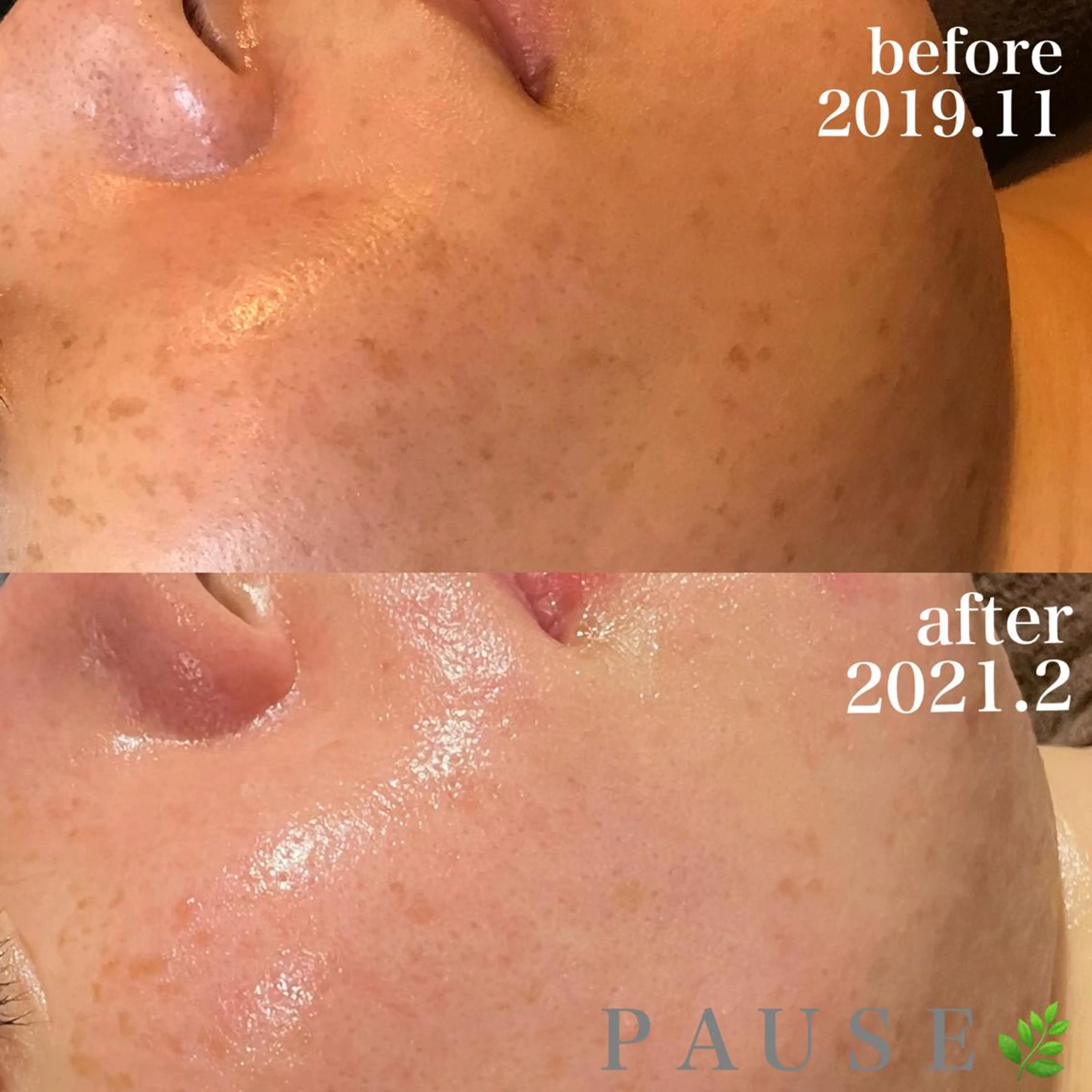 エステ 浜野 恵美のエステ・リラクイメージ