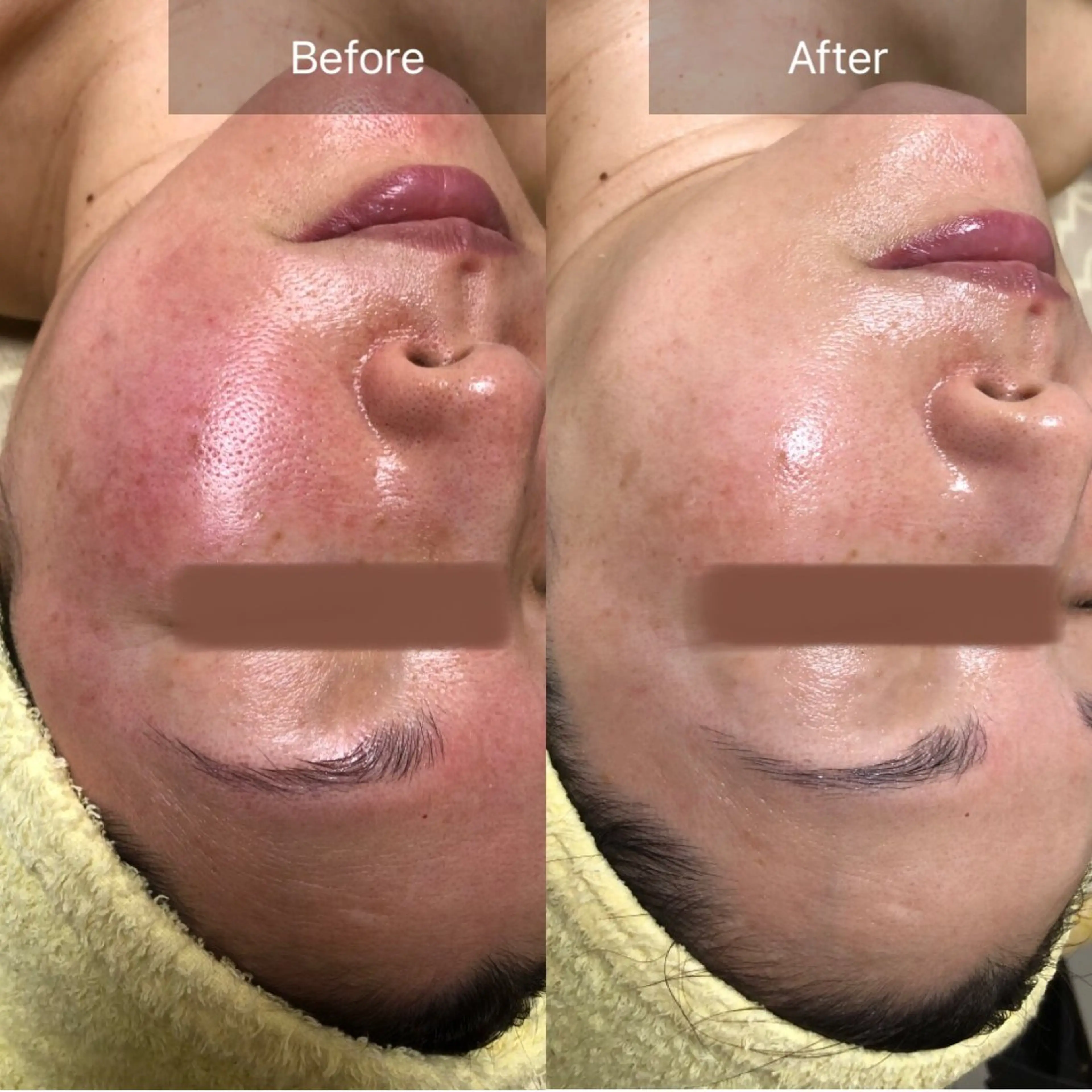 Chio-RE所属・Wax/絹肌艶肌🌼 坂結加のエステ・リラクイメージ