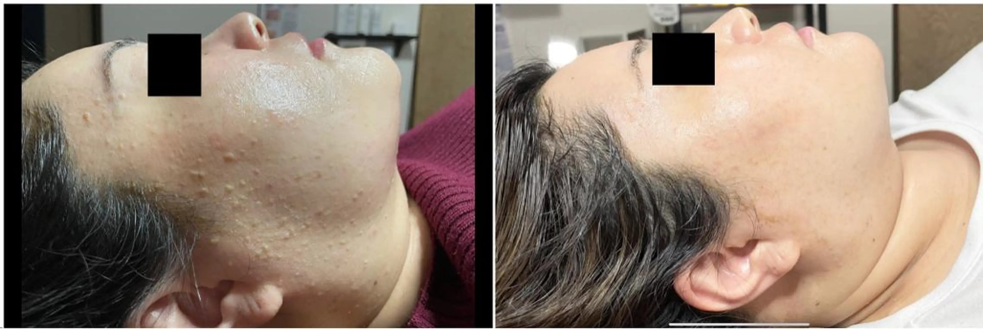 代表 MOMOのエステ・リラクイメージ