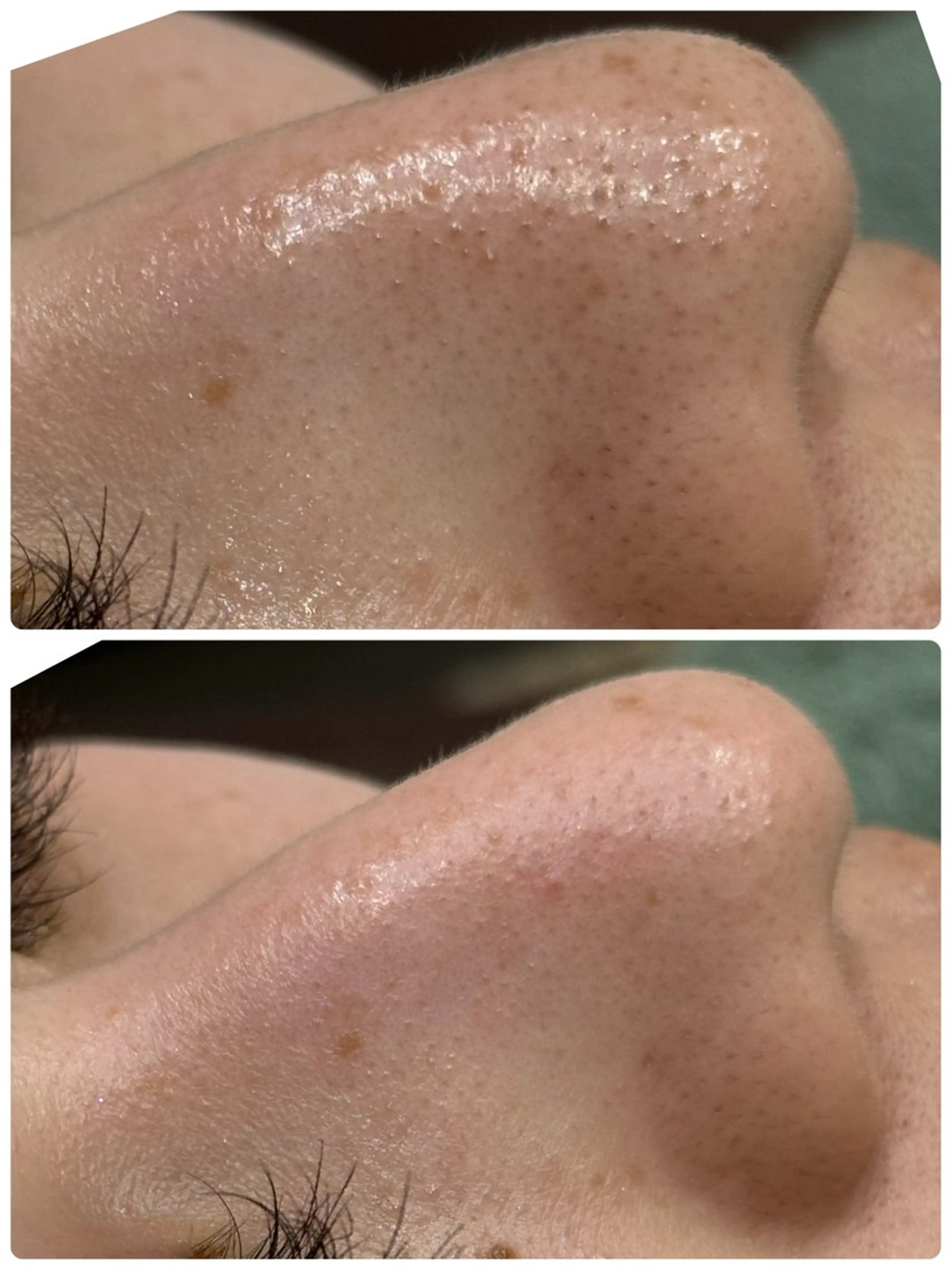 脱毛&フェイシャル 専門店muro.のエステ・リラクイメージ