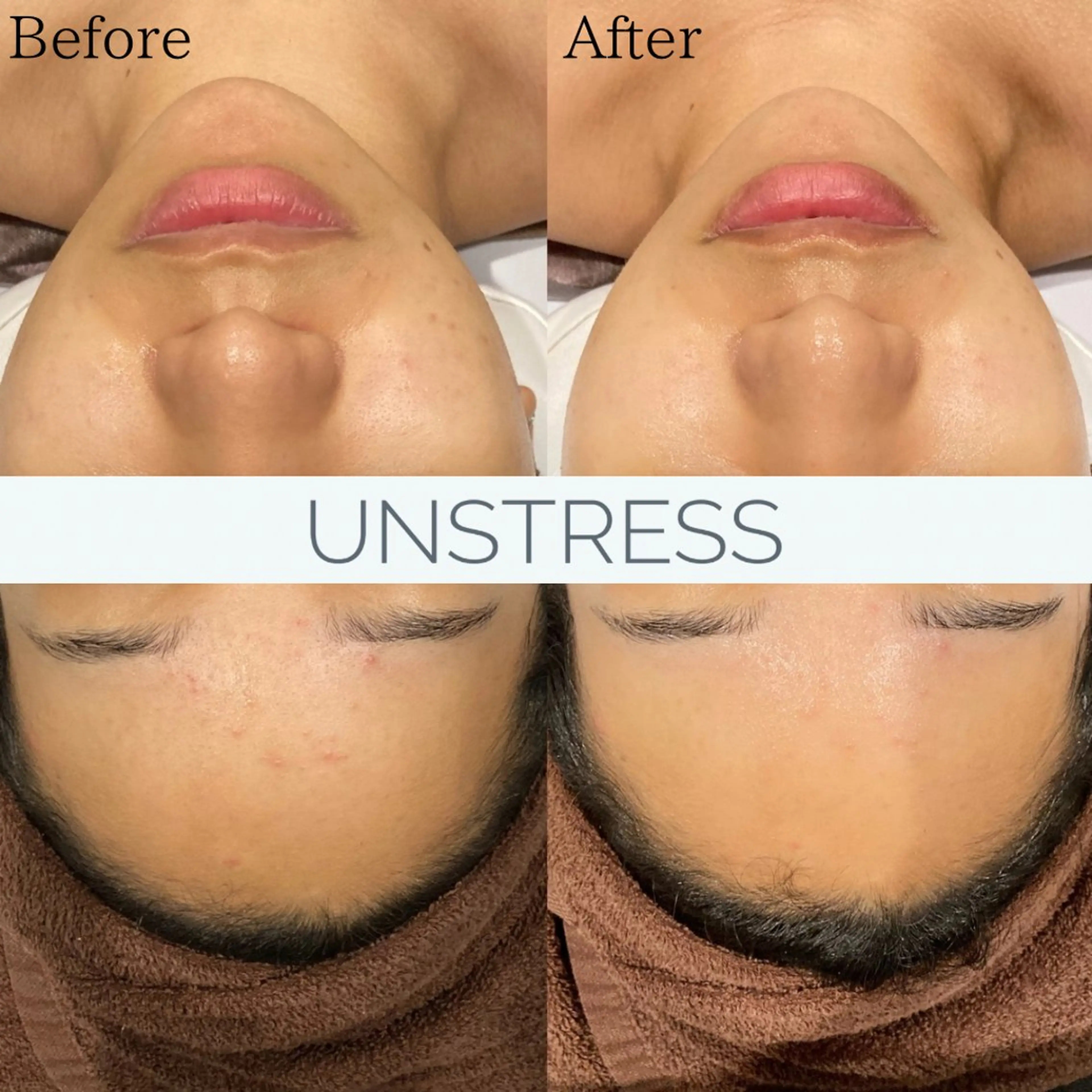 エステ Dahlia Beautyのマツエク・マツパデザイン