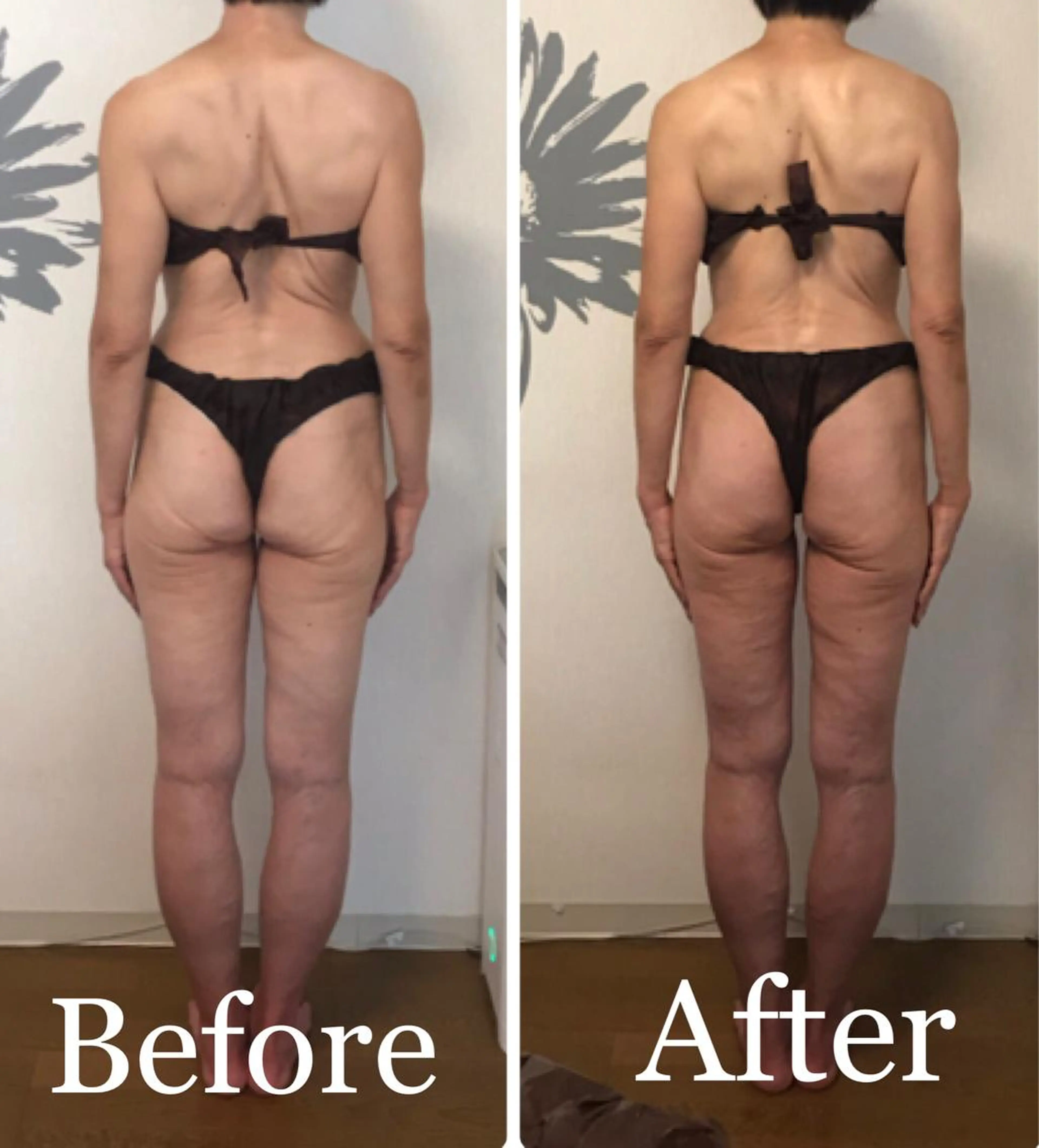 ショート カラー パーマ ヘアアレンジ ネイル マツエク・マツパ さくら夙川駅徒歩3分 最新韓国施術|脚やせのエステ・リラクイメージ