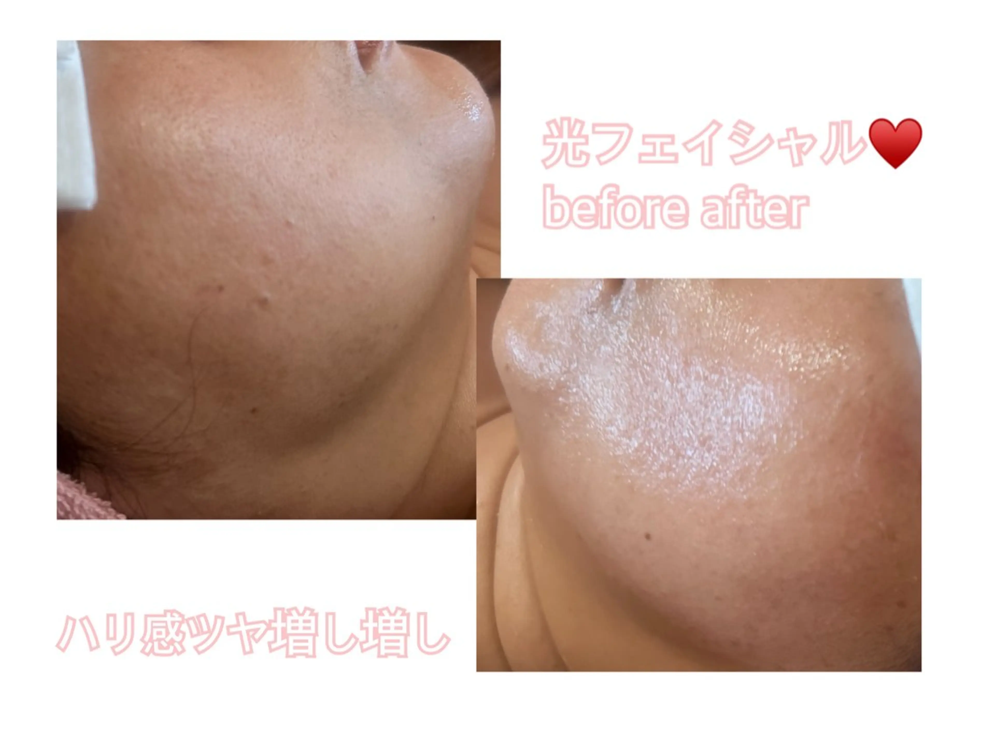 エステ プライベートサロン Allureアルーアのエステ・リラクイメージ