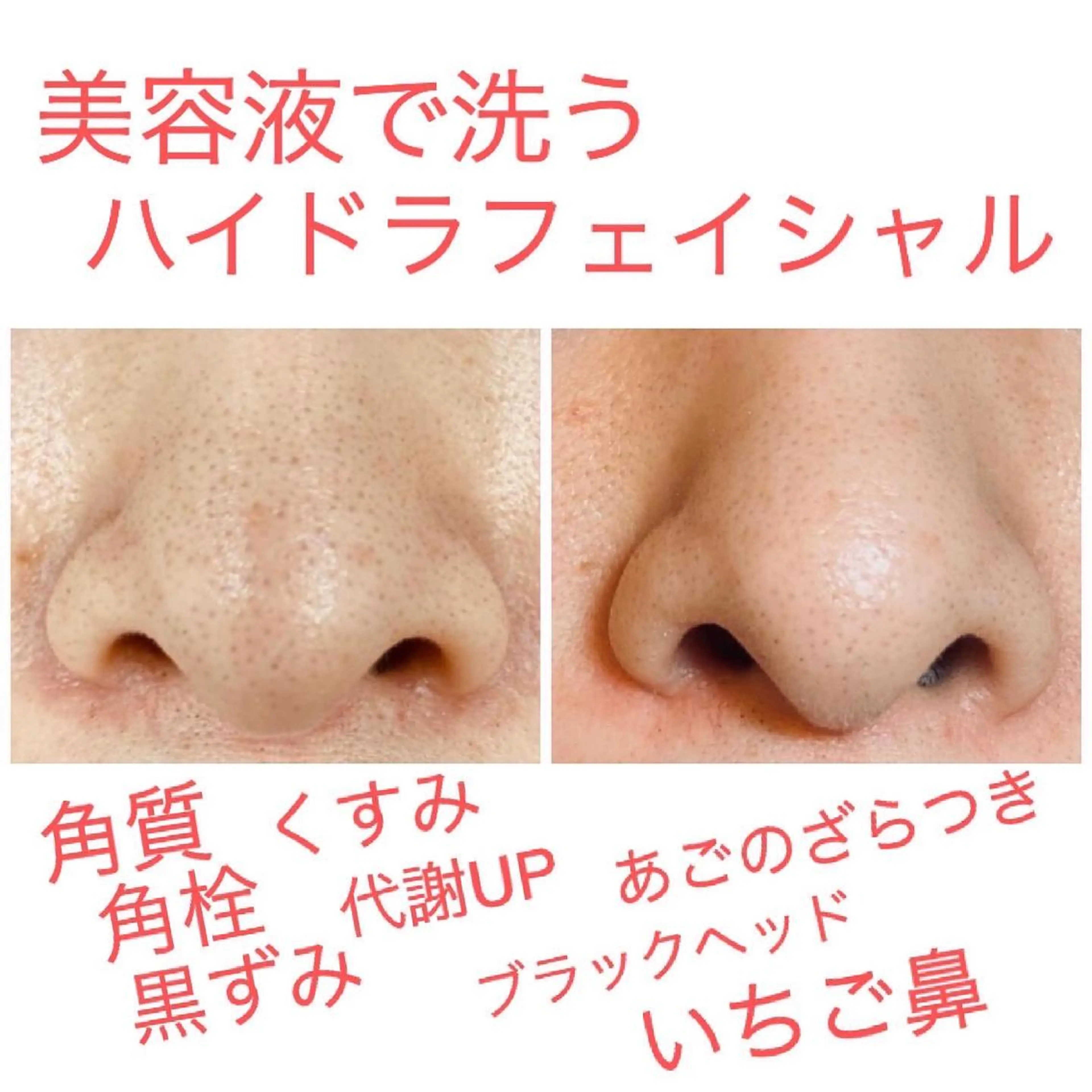 プリート毛穴洗浄美肌 Pulitoのエステ・リラクイメージ