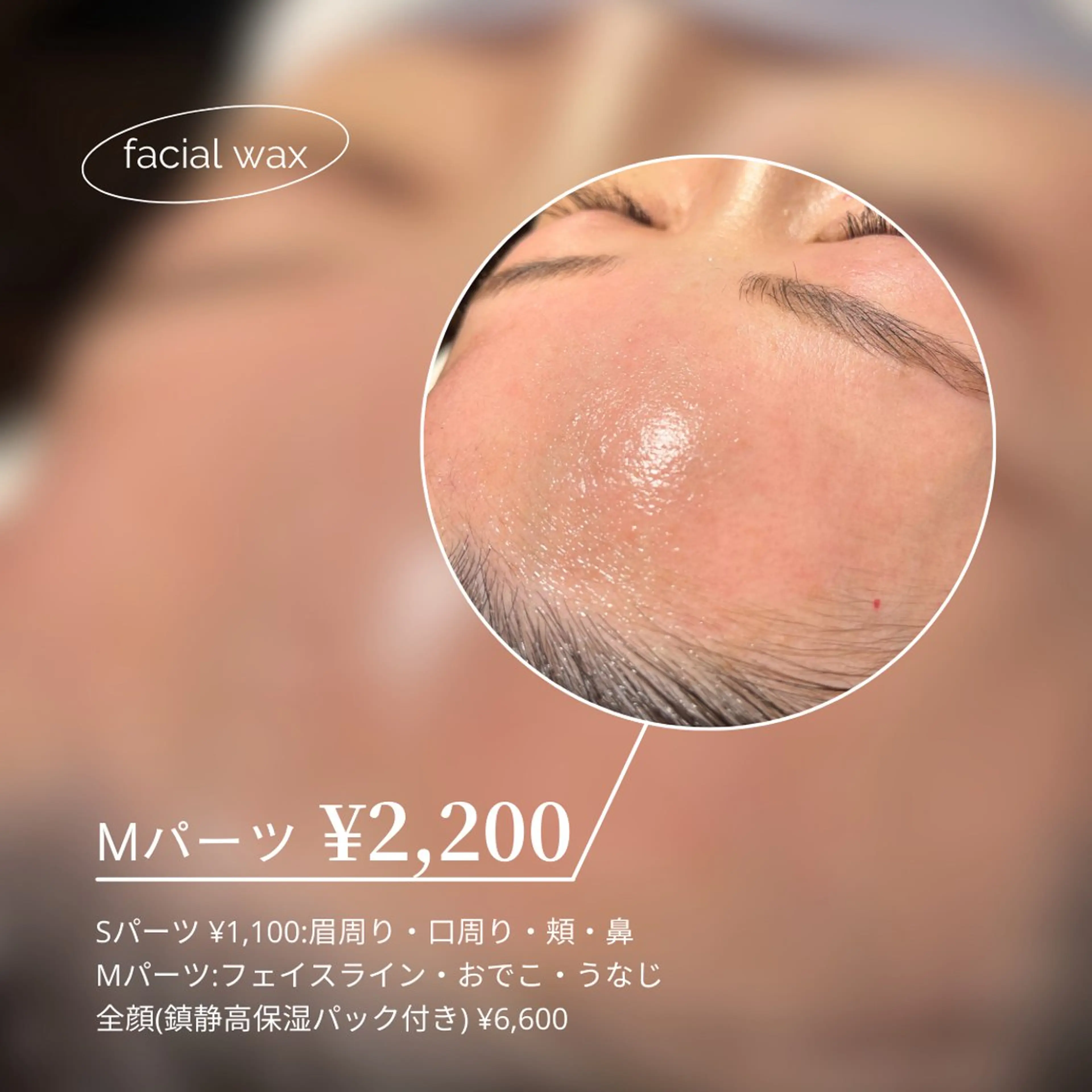 【最強SET✨】美眉HBL+全顔WAX💫垢抜け即実感◎の写真