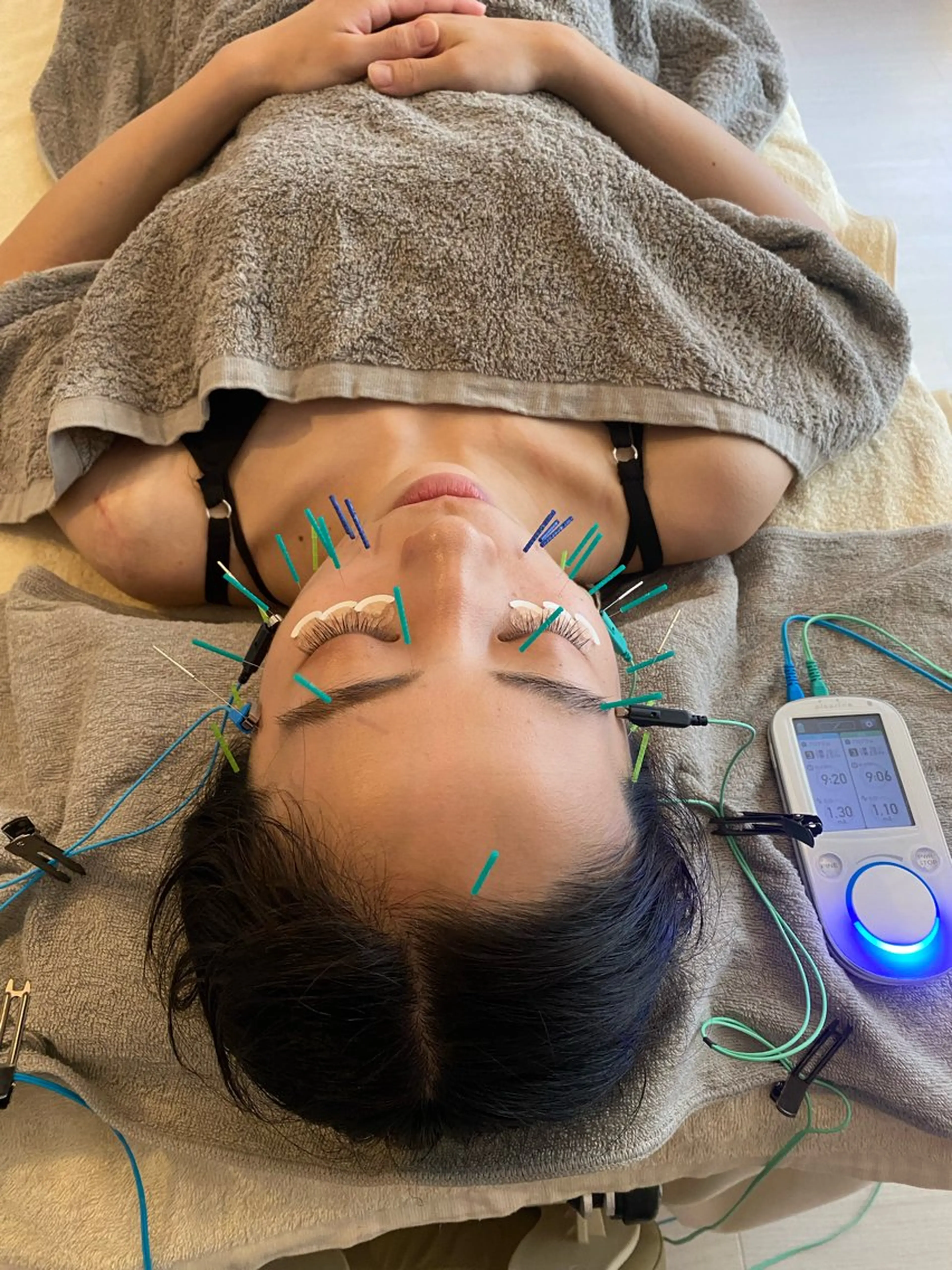 エステ リラク 《美肌･小顔》美容鍼 ＆マッサージ＊MEIのエステ・リラクイメージ