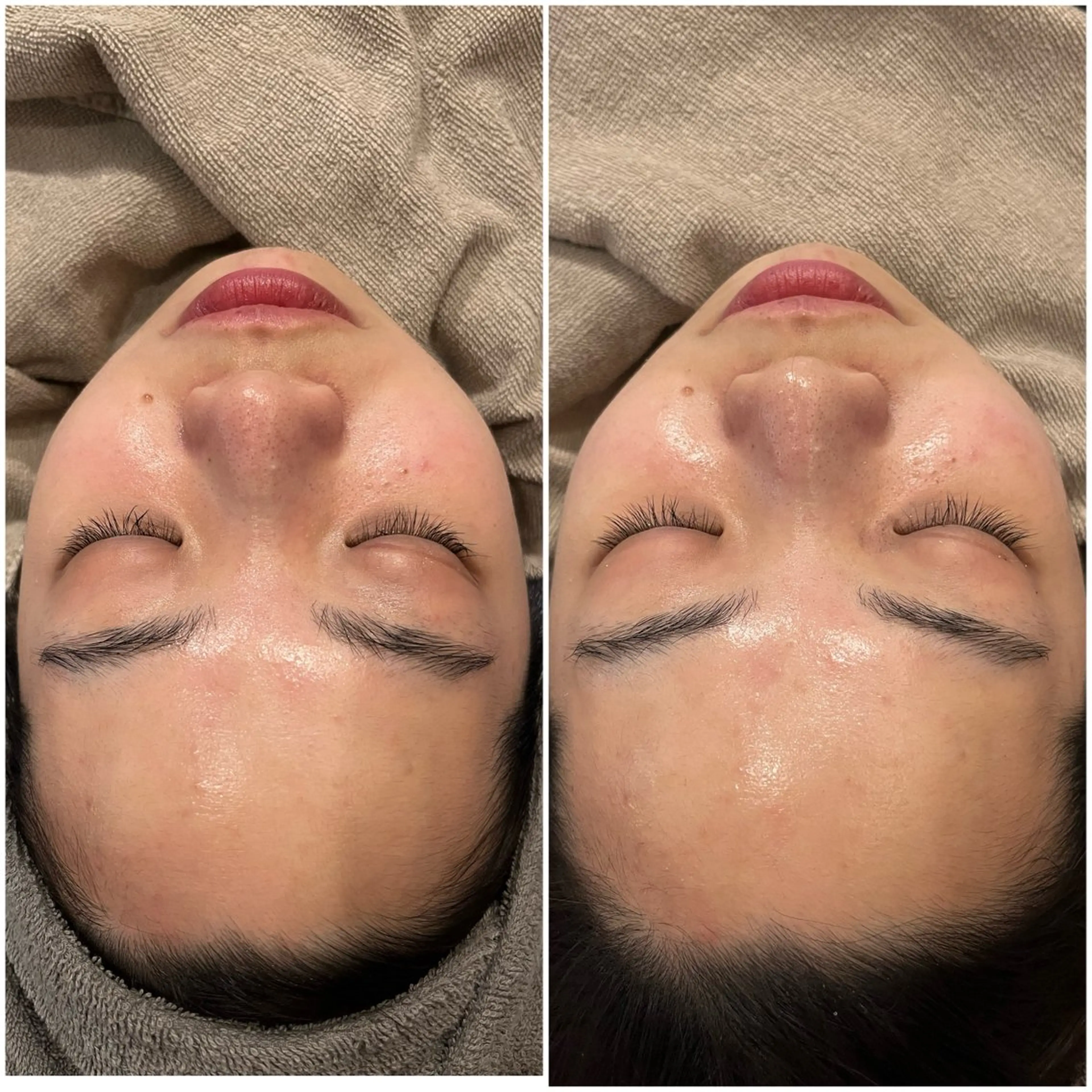 エステ yellow.所属・yellow💛【 脱毛&フェイシャル】のエステ・リラクイメージ