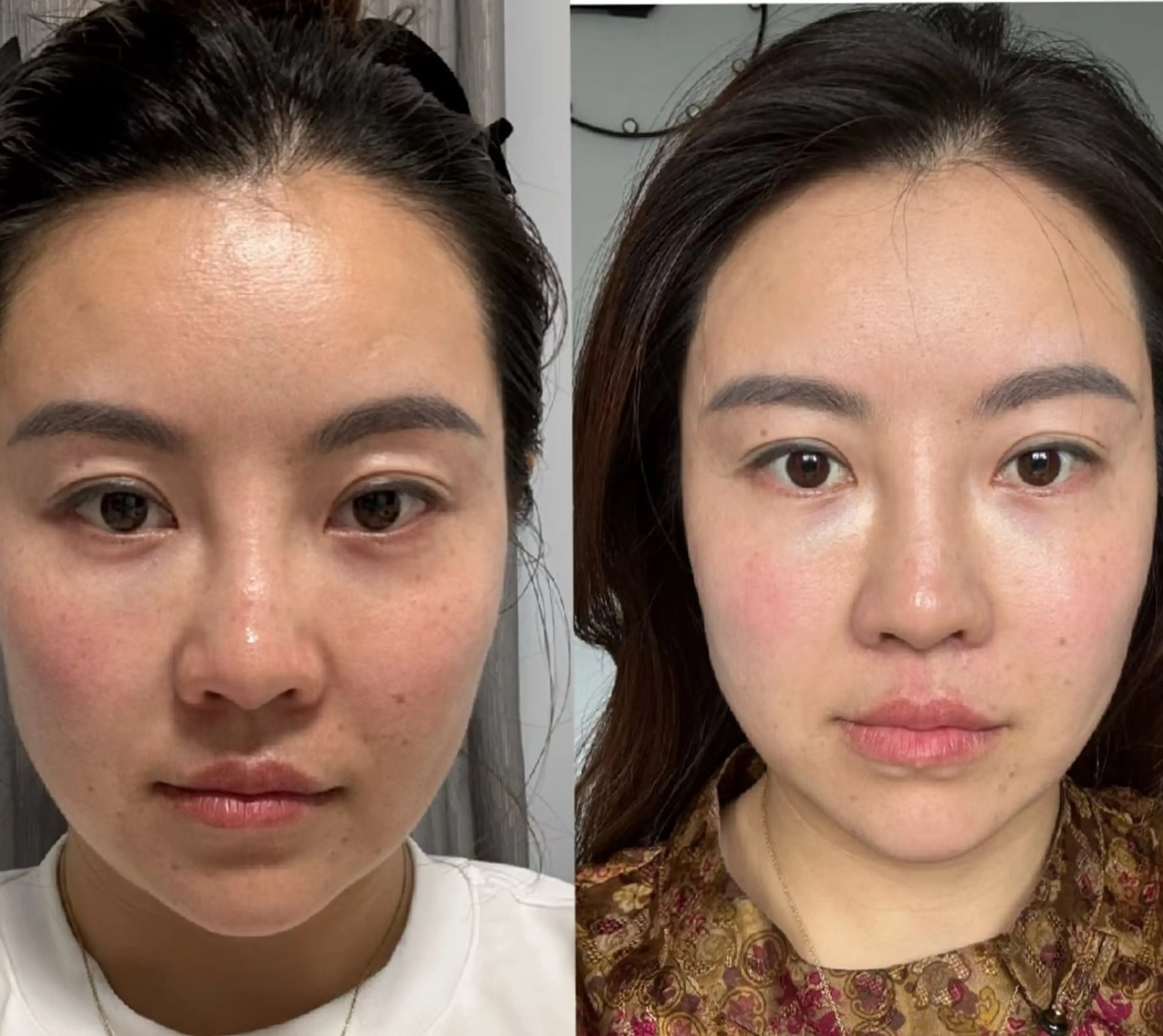 エステ aliaハーブ水光店 エステティシャン募集のエステ・リラクイメージ