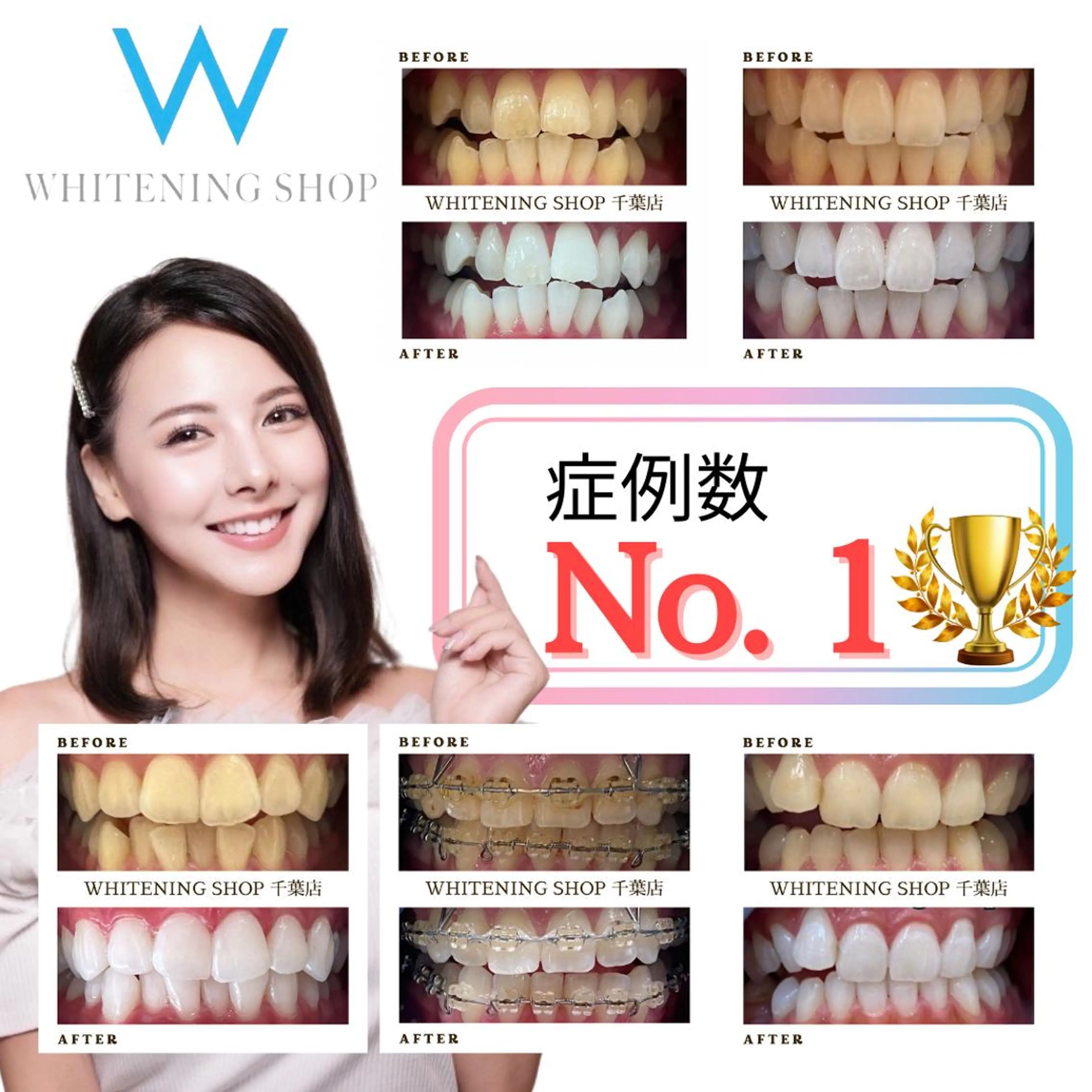 メンズ エステ ホワイトニング ショップ千葉店のその他イメージ